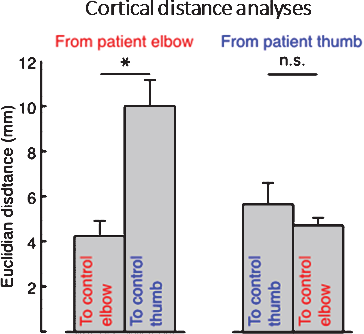 Average cortical distances between patients’ elbow and thumb flexion activation centers of gravity (CoGs) and control participant’s CoGs, showing that the distance from patient’s elbow CoG to the average control participant’s elbow CoG was significantly smaller than the distance from patient’s elbow CoG to the average control thumb CoG, whereas patient’s thumb CoG was not more near neither the average control’s thumb or elbow CoG. Error bars indicate standard error of the mean. Significance of planned comparisons (one-tailed t-tests) are denoted as follows:  *p < 0.05, n.s. p > 0.05.