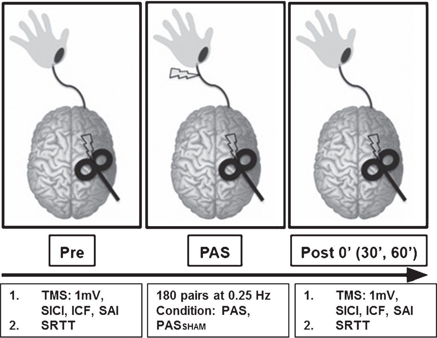 Experimental paradigm. During the PAS protocol 180 pulse pairs using an interstimulus interval of N20+5 ms at 0.25 Hz were delivered over the median nerve and primary motor cortex. Measures of corticomotor excitability (1 mV, SICI, ICF, SAI) and motor skill performance (SRTT) were assessed at baseline, immediately following PAS (POST 0) and at 30 and 60 minutes following PAS (POST30 an POST60). (SICI: short interval cortical inhibition, ICF: intracortical facilitation, SAI: short afferent inhibition, SRTT: serial reaction time task).