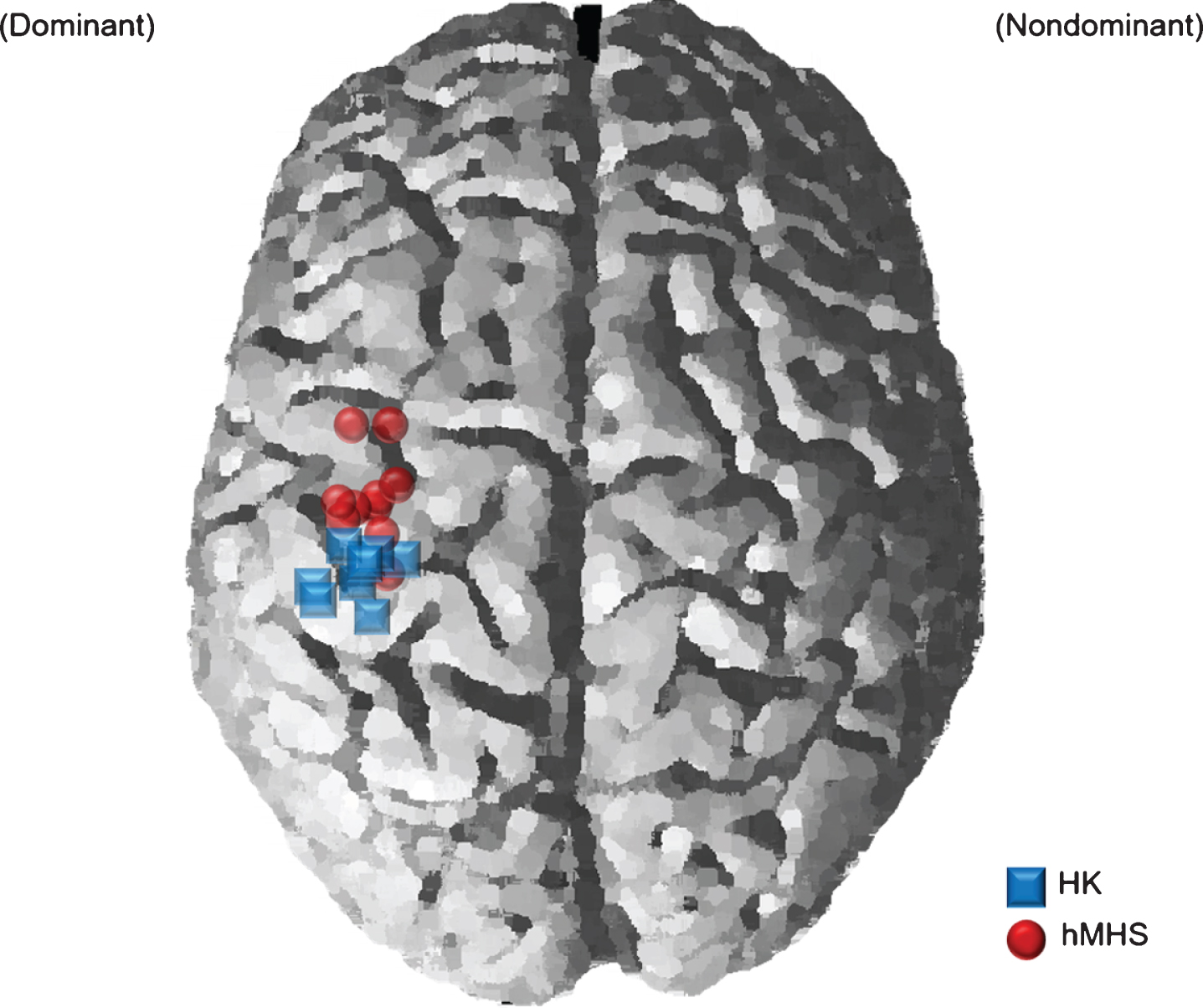 Comparison of repetitive transcranial magnetic stimulation (rTMS) target Montreal Neurological Institute (MNI) locations between the motor hotspot and the hand-knob. The blue squares represent the individual MNI locations of the hand knobs (HK), and the red circles represent the individual MNI locations of hand motor hotspots (hMHS). rTMS, repetitive transcranial magnetic stimulation; MNI, Montreal Neurological Institute; HK, anatomical hand knob; hMHS, hand motor hotspot