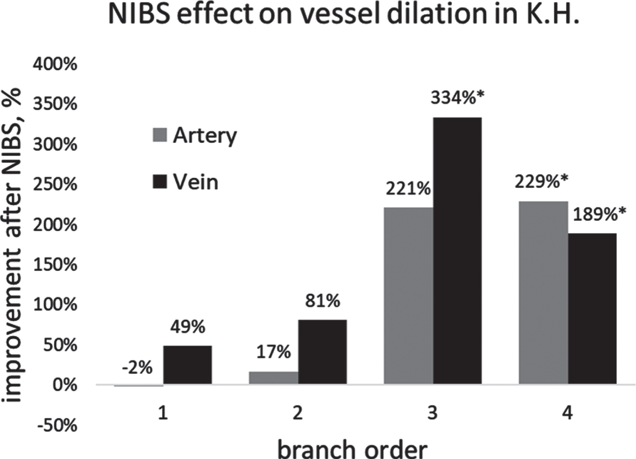 Percent change over baseline of maximal dilation after NIBS treatment as a function of branch order of arteries and veins. Branches of lower order are smaller than branches of higher order. % improvement = (post-pre)/pre×100. *Note that the samples size of third order vein, fourth order artery and vein are only 2, 2, 1.