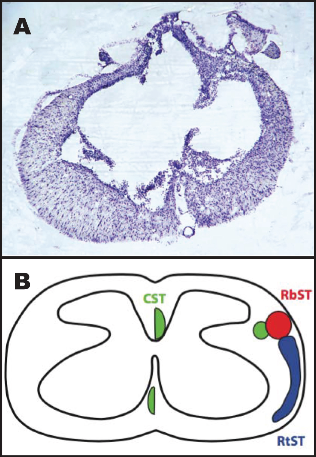 Representative image of the spinal cord injury epicenter 4 weeks after injury. A: Transverse section stained with a cresyl violet acetate solution. B: Schematic diagram showing the location of descending motor tracts (Lemon, 2008): the corticospinal tract (CST; green), rubrospinal tract (RbST; red), and reticulospinal tract (RtST; blue).