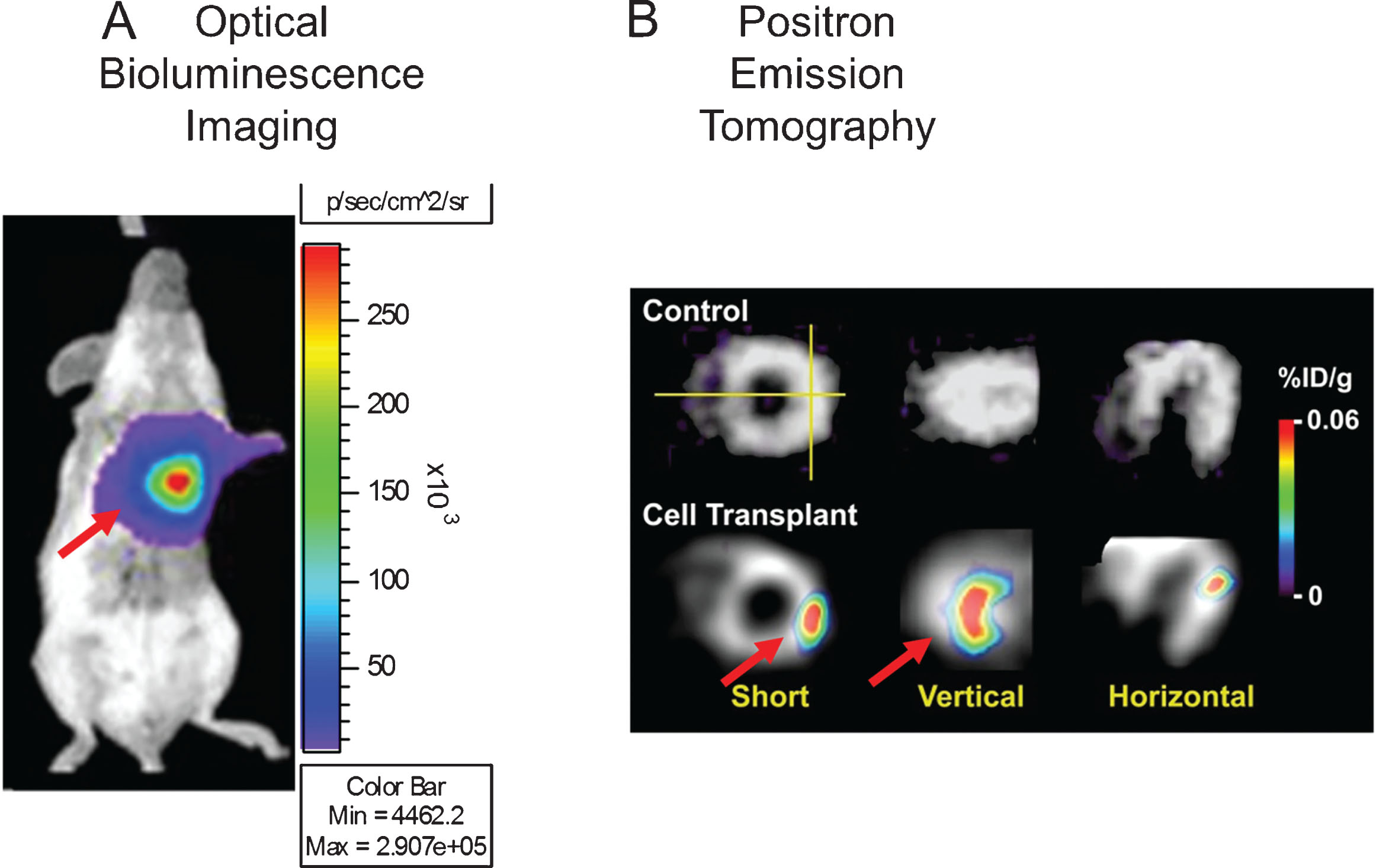 Examples of reporter gene imaging. Panel A, shows the different imaging modalities used in reporter gene imaging, such as optical bioluminescence imaging (left), and radionuclide medicine imaging (PET-right). Subjects are placed in the cooled CCD camera system or scanner, respectively, and the substrate administered. Panel B presents examples of cell imaging using a reporter gene approach using the previously mentioned modalities. On the left panel, cells are genetically modified to carry the optical fluc reporter gene, delivered to the myocardium, and also imaged using a CCD camera after administration of the substrate D-Luciferin. Color images of visible light are superimposed on photographic images of mice with a scale in photons per second per square centimeter per steradian (sr). On the right panel, cells carrying the PET reporter gene HSV1-tk have been transplanted to the myocardium. The figure depicts tomographic images of the myocardium after the administration of the PET reporter probe 18Fluorine 9-[4-fluoro-3-(hy{droxy methyl)butyl]guanine (18F-FHBG). The color scale (% ID/g) indicates the percentage of injected dose that accumulates per gram of tissue. Red arrows indicate the area where cells are located. Reprinted from Cao F, et al. In Vivo Visualization of Embryonic Stem Cell Survival, Proliferation, and Migration After Cardiac Delivery. Circulation 2006; 113(7):1005-1014 and Lijkwan MA, et al. Trends Cardiovascular Medicine 2010; 6:183-8 with permission.