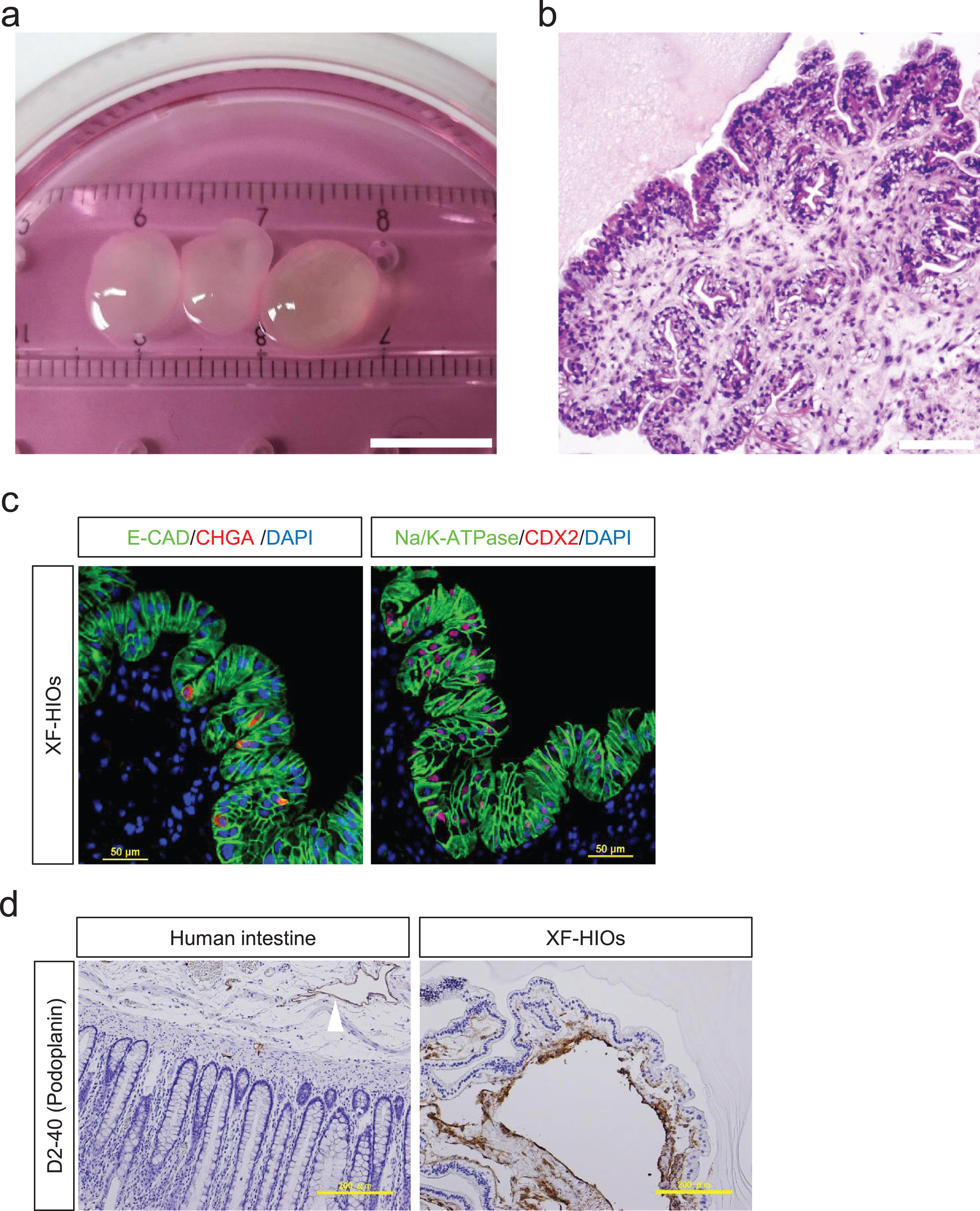 Characterization ofintestinal organoids from human embryonic stem cells. (a) In vitro culture of Xenogeneic-free human intestinal organoids (XF-HIOs) generated from hESCs. The XF-HIOs are stably maintained in a xenogeneic-free medium. Scale bar corresponds to 10 mm. (b) Hematoxylin and eosin (HE) staining of organoids on day 100. Scale bar corresponds to 200 μm. The XF-HIOs are structured outwards andoriented towards the epithelial layers. (c) Immunostaining for Chromogranin A (CHGA), caudal type homeobox 2 (CDX2), and Na/K-ATPase. Cell nuclei were counterstained with 4′,6-diamidino-2-phenylindole, dihydrochloride (DAPI). Scale bars correspond to 50 μm. (d) Under the epithelial layers of the XF-HIOs, cyst-like structures were lined with the lymphatic endothelial marker, D2-40 positive cells (Fig. 1d). Immunohistochemical staining for lymphatic endothelium marker Podoplanin (D2-40) in XF-HIOs and in healthy adult human intestine (white arrowhead) as control. Cystic structures of the XF-HIOs lined by D2-40 positive cells. Scale bars correspond to 200 μm.