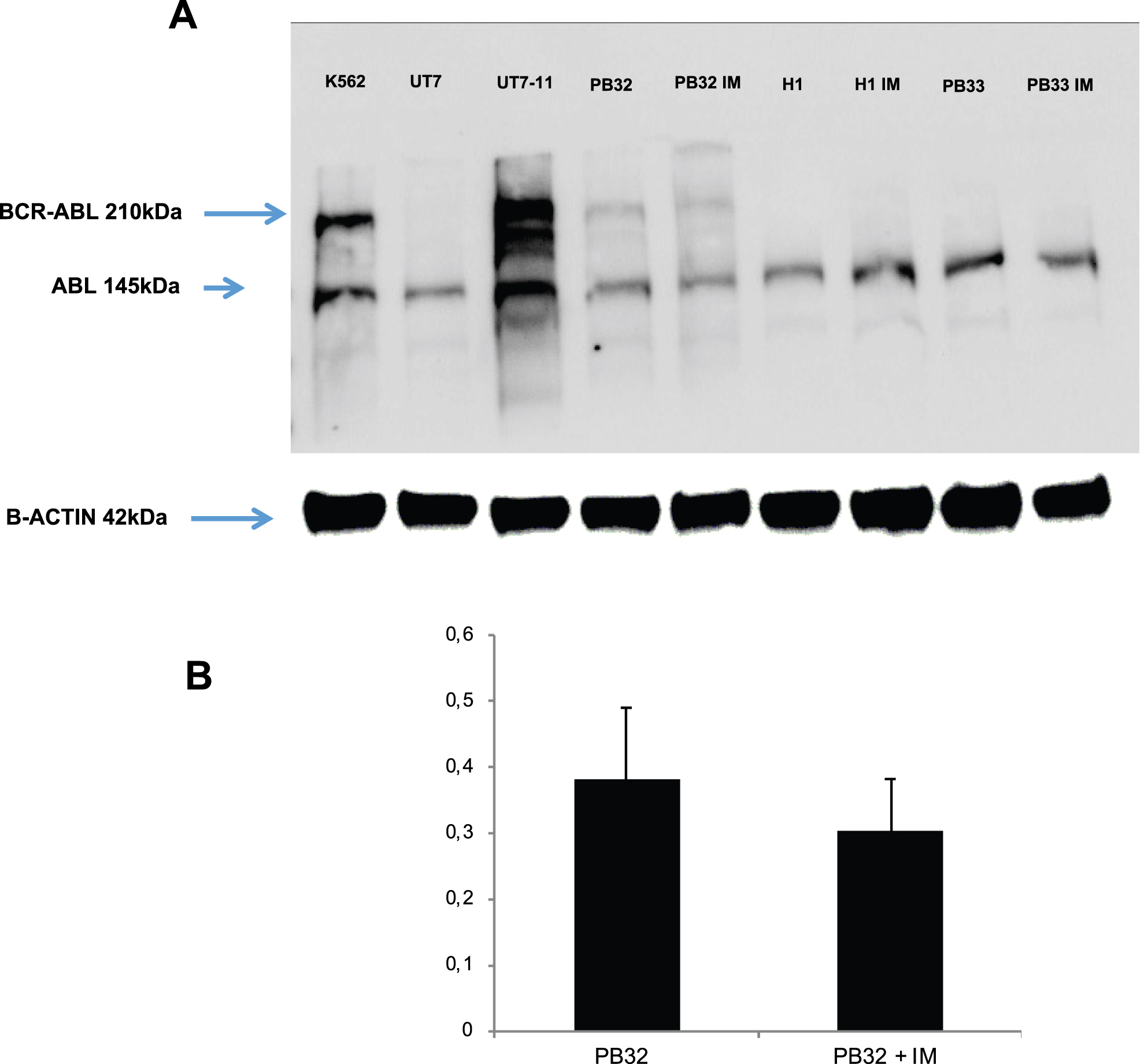 (A) Western blot analysis for the evaluation of BCR-ABL expression in CML iPSC line PB32 as compared to control cell lines. Lane 1: BCR-ABL expressing K562 cell line; Lane 2: Control UT7 cell line; lane 3.:UT7-11 cell line expressing BCR-ABL; Lane 4 and 5: CML IPSC line PB32 before and after exposure to Imatinib (PB32-IM); (lane 6 to 9): control hESC line H1 and control IPS cell line PB33 before and after exposure to imatinib. (B) Expression of BCR-ABL in CML IPS PB32 by RT-q-PCR before and after exposure to Imatinib.