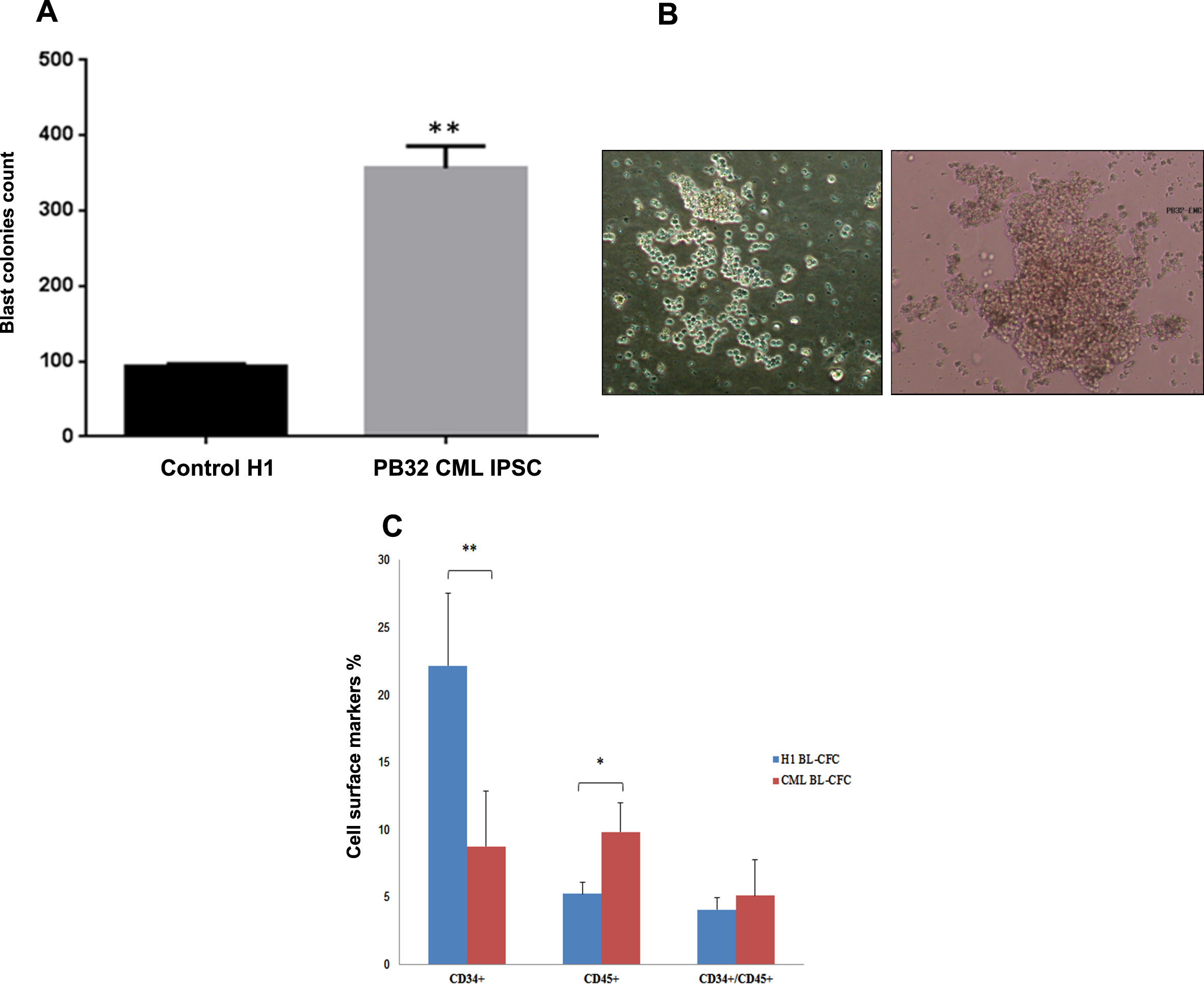 Impact of BCR-ABL expression in hematopoietic potential of CML IPS derived Bl-CFC. (A) Blast colony forming cells (Bl-CFC) derived from control embryonic stem cell line H1 and PB32 CML iPSC. (B) Representative photos of Bl-CFC. (C) Flow cytometry analysis of hematopoietic markers CD34 and CD45 in Bl-CFC derived from control ESC (H1) and PB32 CML iPSC.