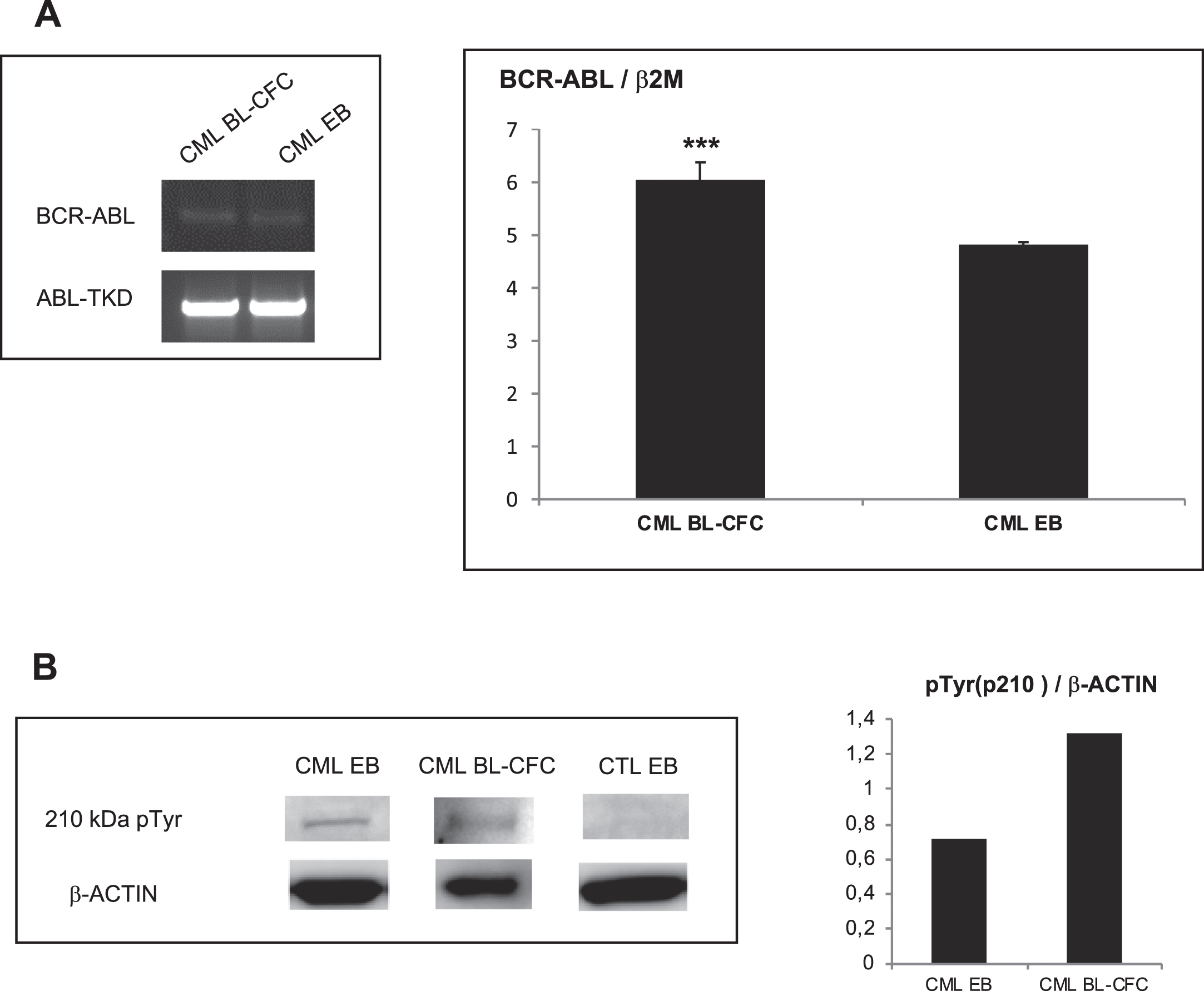 BCR-ABL expression in embryoid bodies (EBs) and Bl-CFC cells derived from CML iPSC. 5A (Left panel): PCR analysis to detect BCR-ABL in CML iPSC-derived blast colony forming cells (Bl-CFC) and embryoid bodies (EB). 5A (Right panel): Expression profile of BCR-ABL gene by RT-qPCR in CML iPSC-derived Bl-CFC and EB. 5B (Left panel): Western blot analysis to detect BCR-ABL phosphorylation level using a phospho-tyrosine antibody. 5B (Right panel): ImageJ quantification of pTYR in iPSC-derived EB and Bl-CFC.