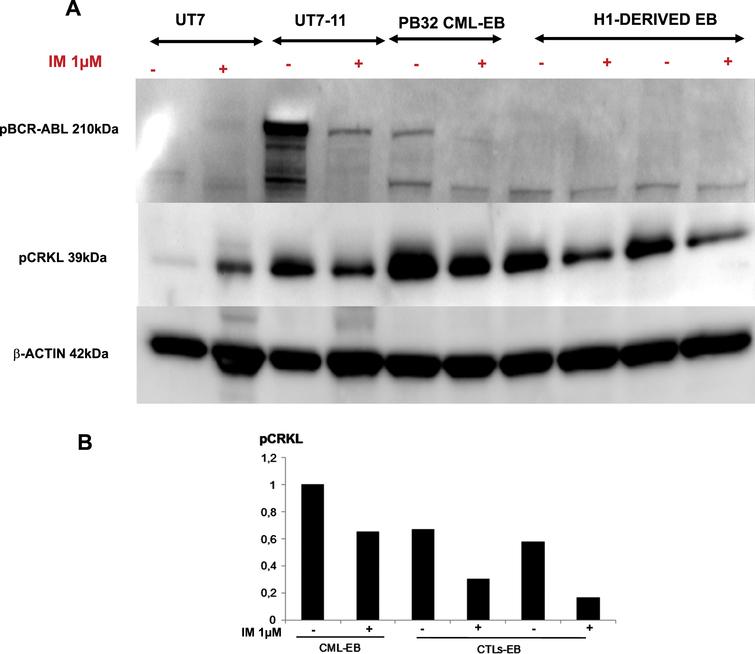 Western blot analyses to evaluate BCR-ABL phosphorylation levels in PB32-CML-iPSC and control cells. (A) Western blot analysis of BCR-ABL phosphorylated protein and Crk-L phosphorylation in CML and control EBs before and after exposure to 1μM Imatinib compared to BCR-ABL negative and and BCR-ABL-positive control cell lines UT7 and UT7/11, respectively. (B) ImageJ quantification of pCrk-L signal compared to β-Actin.