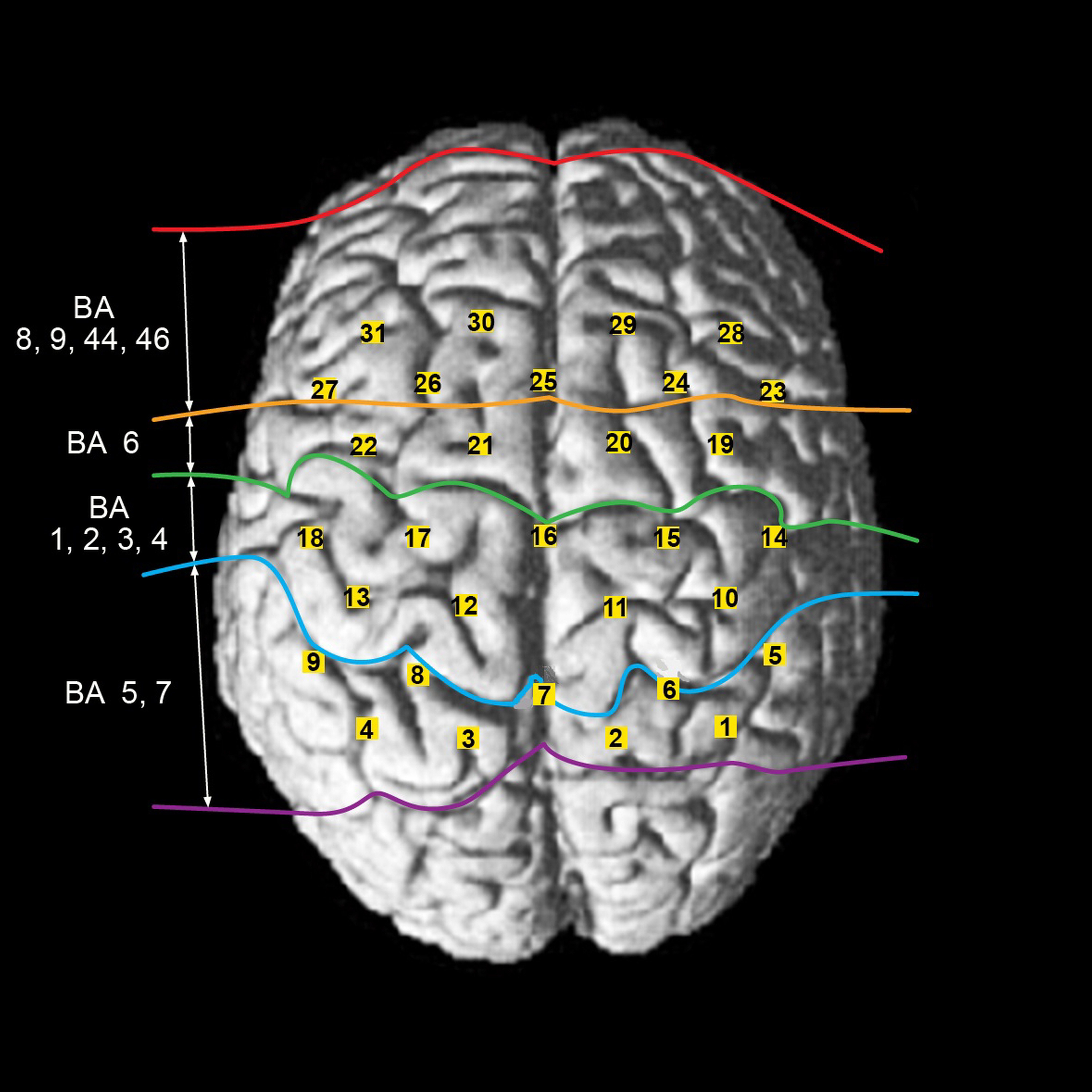 Locations of the 31 channels and their corresponding cortical regions.