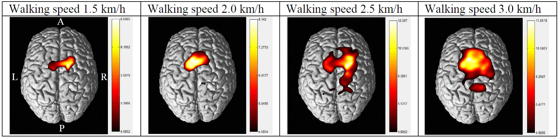 Patterns of cortical activation during different walking speeds.