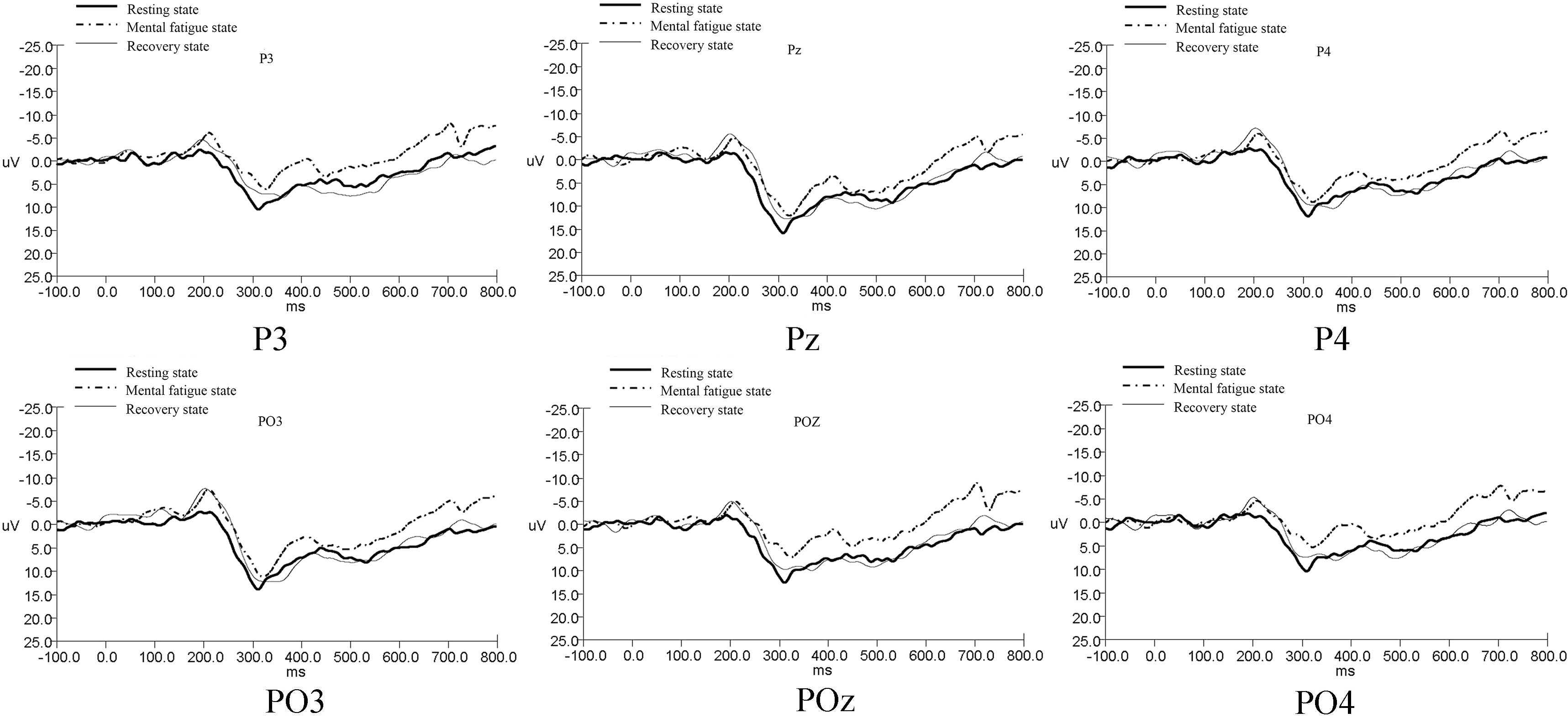 Grand-averaged ERP waveforms of P3b.