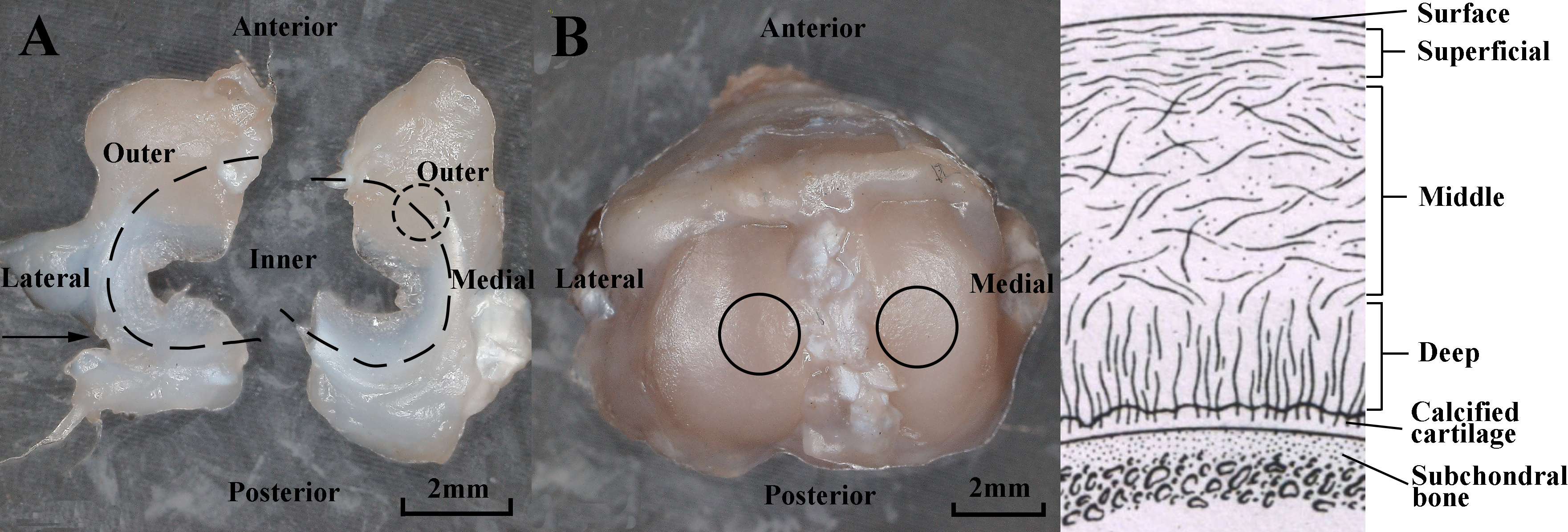 Regional division of menisci and tibial cartilage. A) Optical image of menisci. Dash line circled area shows the typical observed region of menisci. B) Optical image of tibial plateaus. Solid line circled areas show the typical observed regions of tibial cartilage. C) Cross-sectional schematic of tibial cartilage showing a depth-dependent zone. Arrow in sub-figure A represents the slice direction.