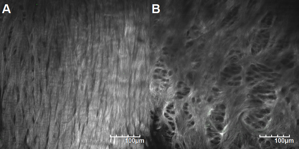 Typical collagen microstructure of the outer region (A) and the inner region (B) of a healthy meniscus.