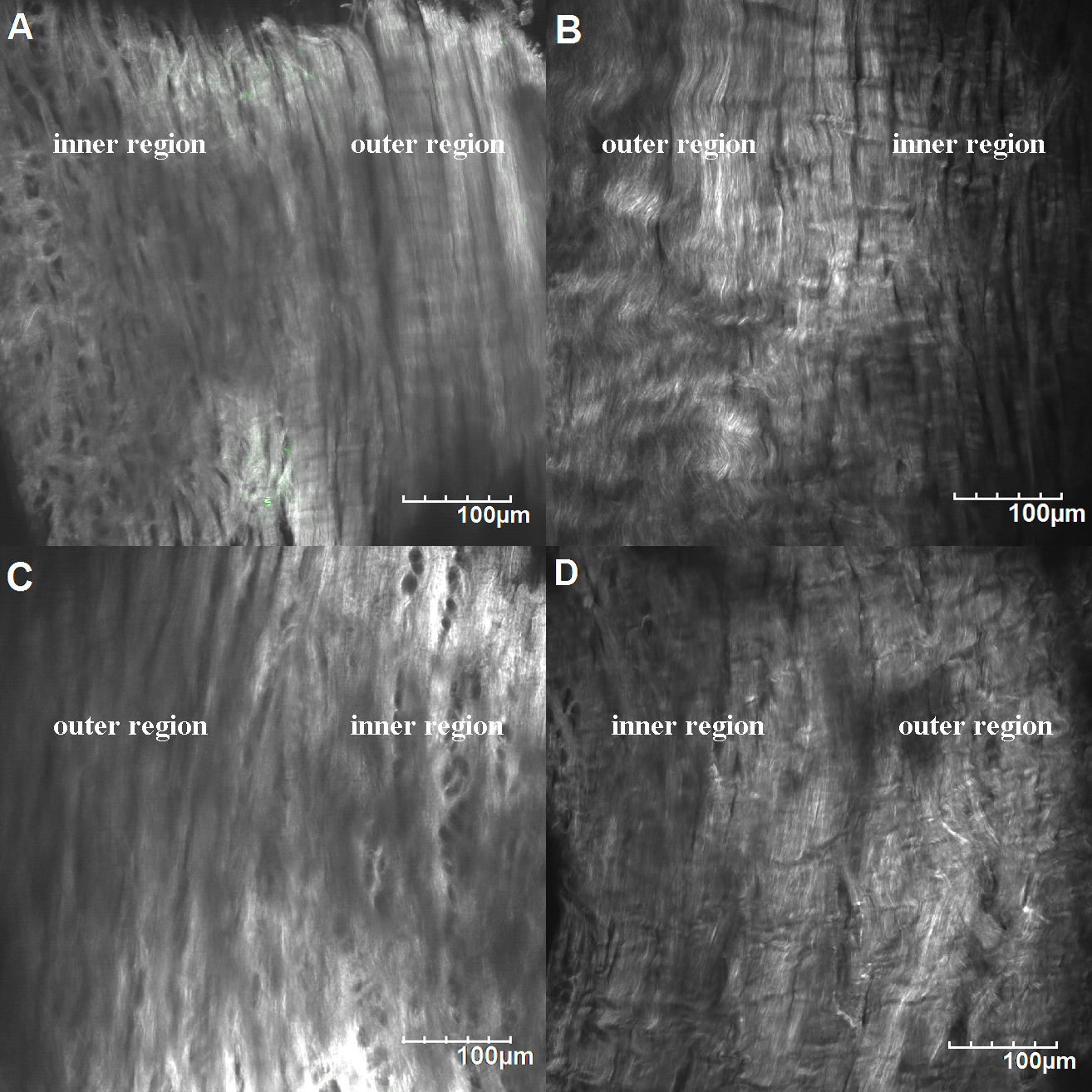 Collagen microstructure of the menisci. A) Medial meniscus of the control group. B) Medial meniscus of the experimental group. C) Lateral meniscus of the control group. D) Lateral meniscus of the experimental group.