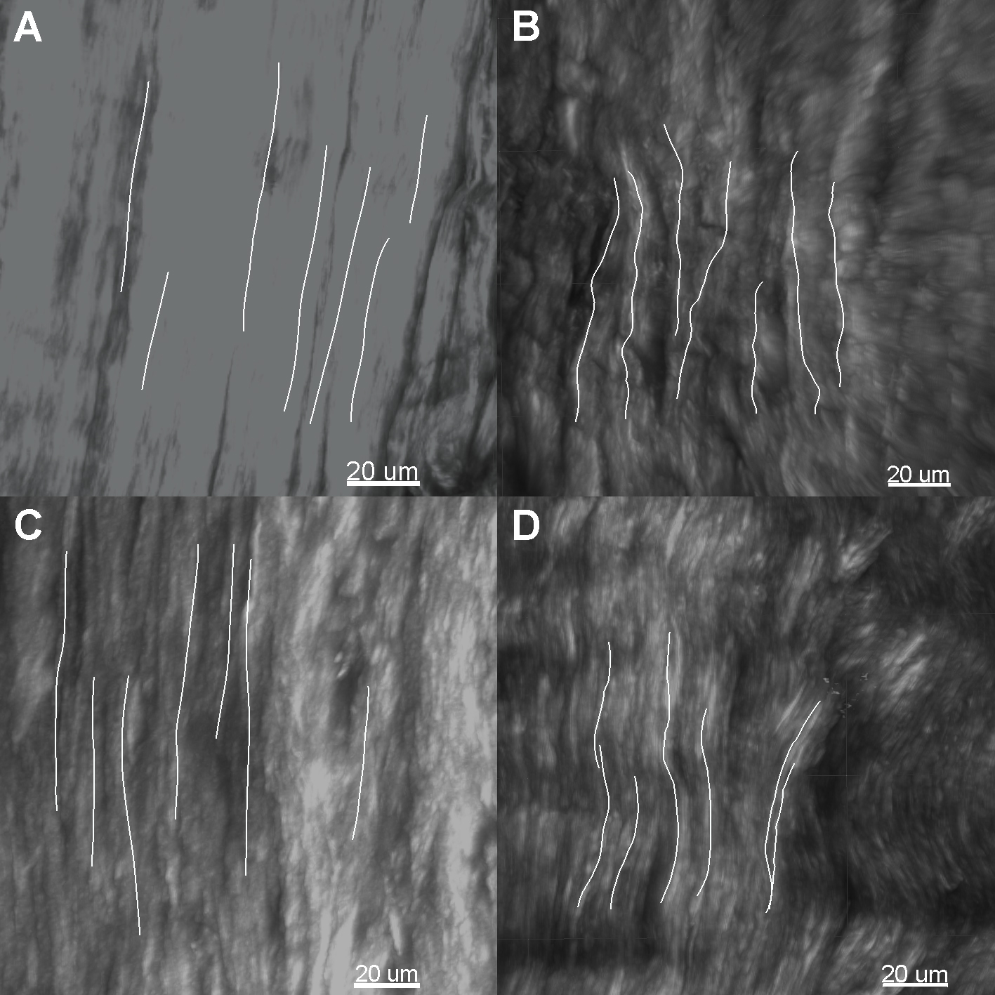Representative collagen fiber straightness measurement of the outer region of the menisci. A) Medial meniscus of the control group. B) Medial meniscus of the experimental group. C) Lateral meniscus of the control group. D) Lateral meniscus of the experimental group.