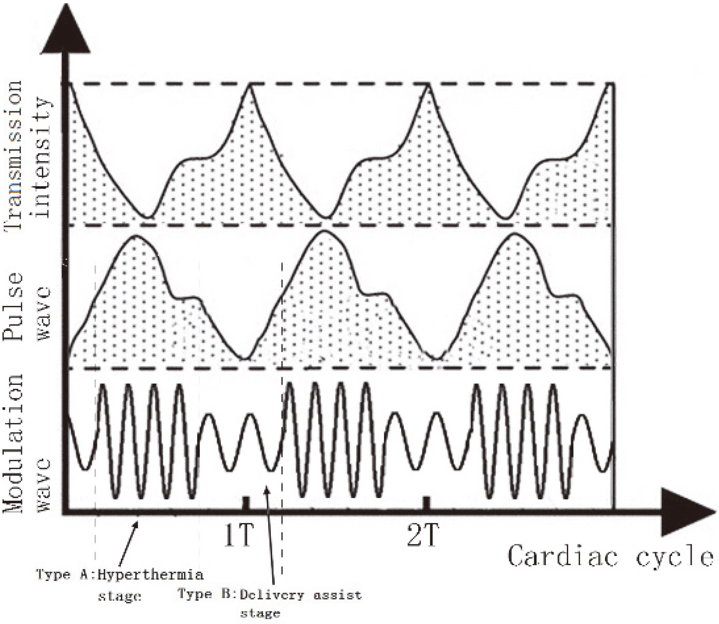 Comparison between alternating frequency and pulse wave.