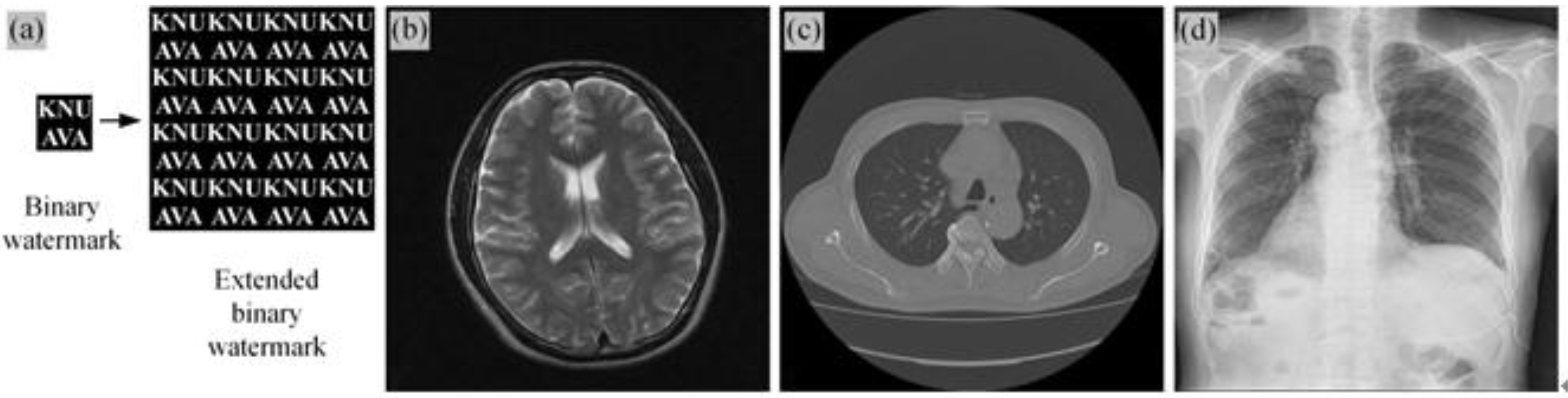 Example of the proposed watermark generation method and selected medical images in the simulation: (a) watermark generation and (b) MRI, (c) CT, and (d) X-ray images.