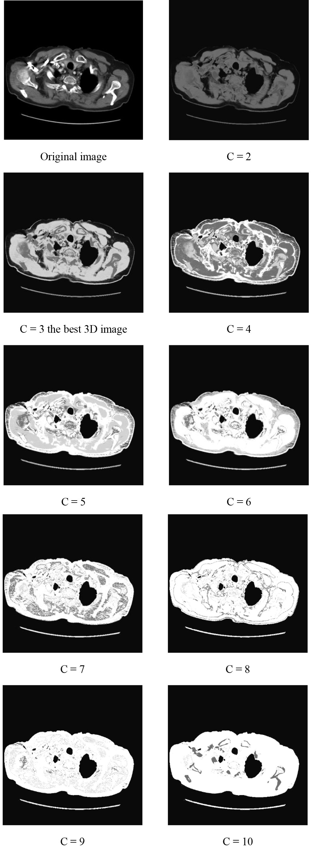 CT image of musculoskeletal tissues in different number of clusters.