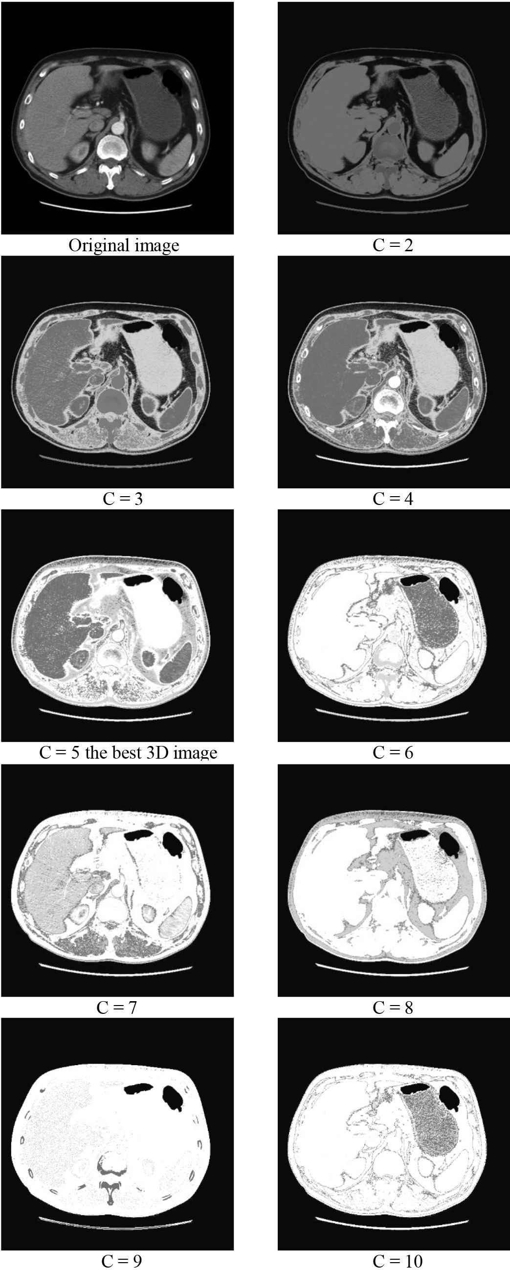 CT image of Viscera tissues in different number of clusters.
