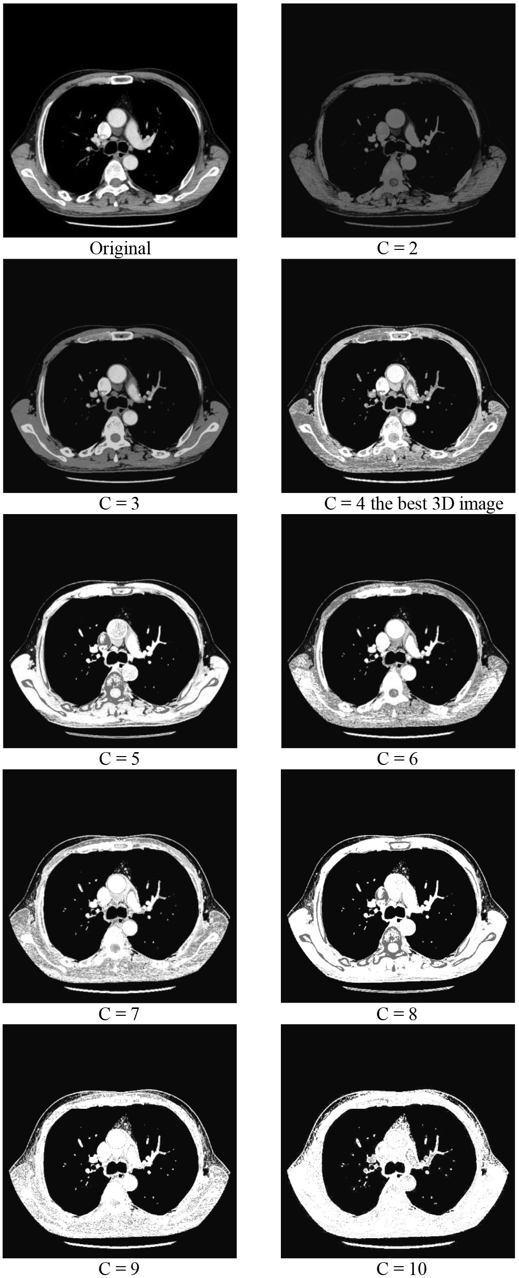 CT image of Lung tissue in different number of clusters.