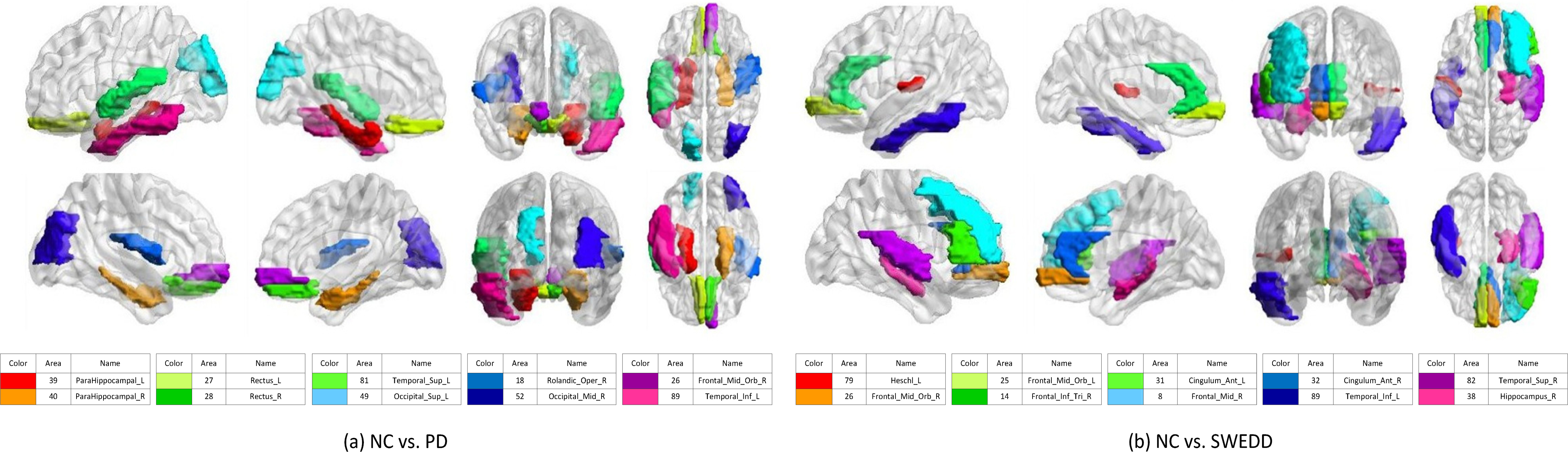 Top 10 discriminative brain regions gained from proposed method for (a) NC vs. PD, and NC vs. SWEDD. Brain regions are color-coded. Moreover, suffix ‘_L’ means left brains, suffix ‘_R’ means right brains, and different colors show different brain regions.