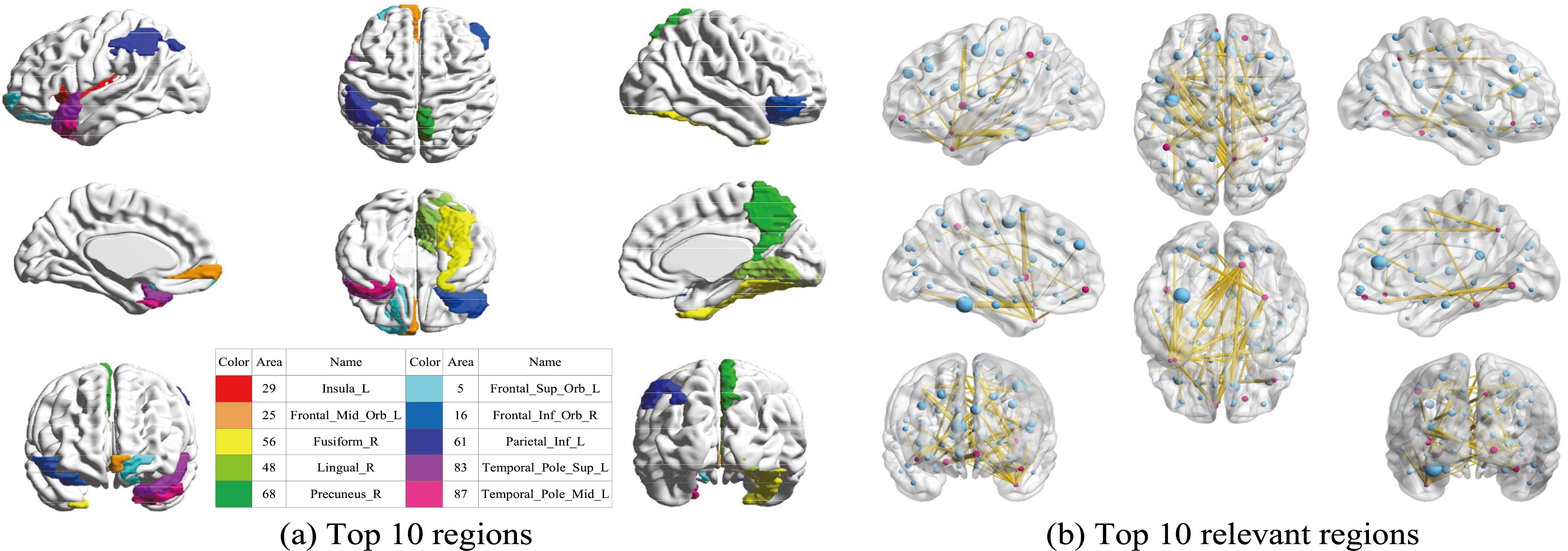 (a) Top 10 discriminative brain regions obtained from proposed method via for NC vs. PD vs. SWEDD. Brain regions were color-coded. (b) Top 10 relevant brain regions (in blue points) for each top 10 discriminative brain region (in red points).