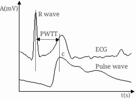 PWTT measurement from ECG and pulse wave signals.