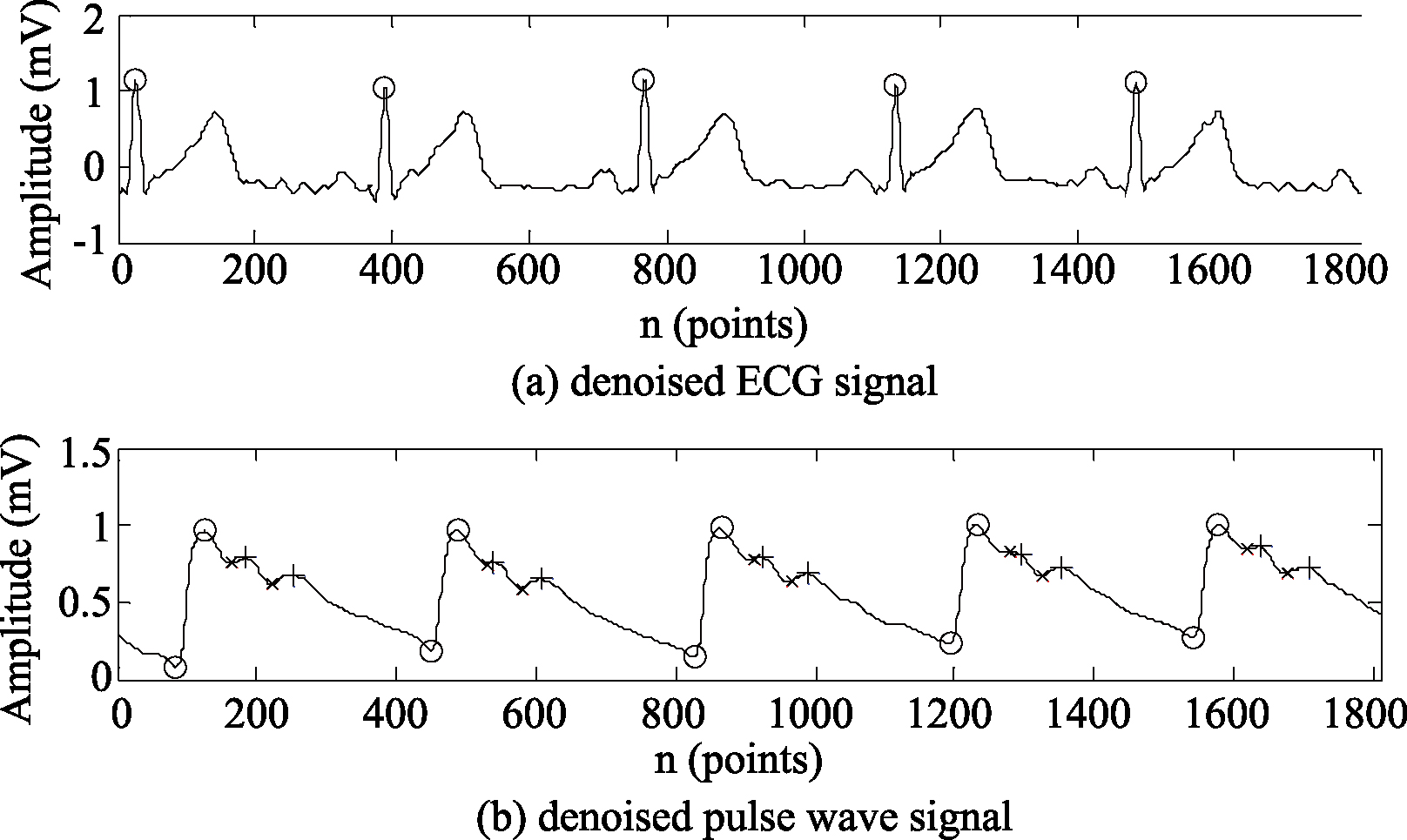 Feature point recognition of the denoised ECG and pulse wave signals.
