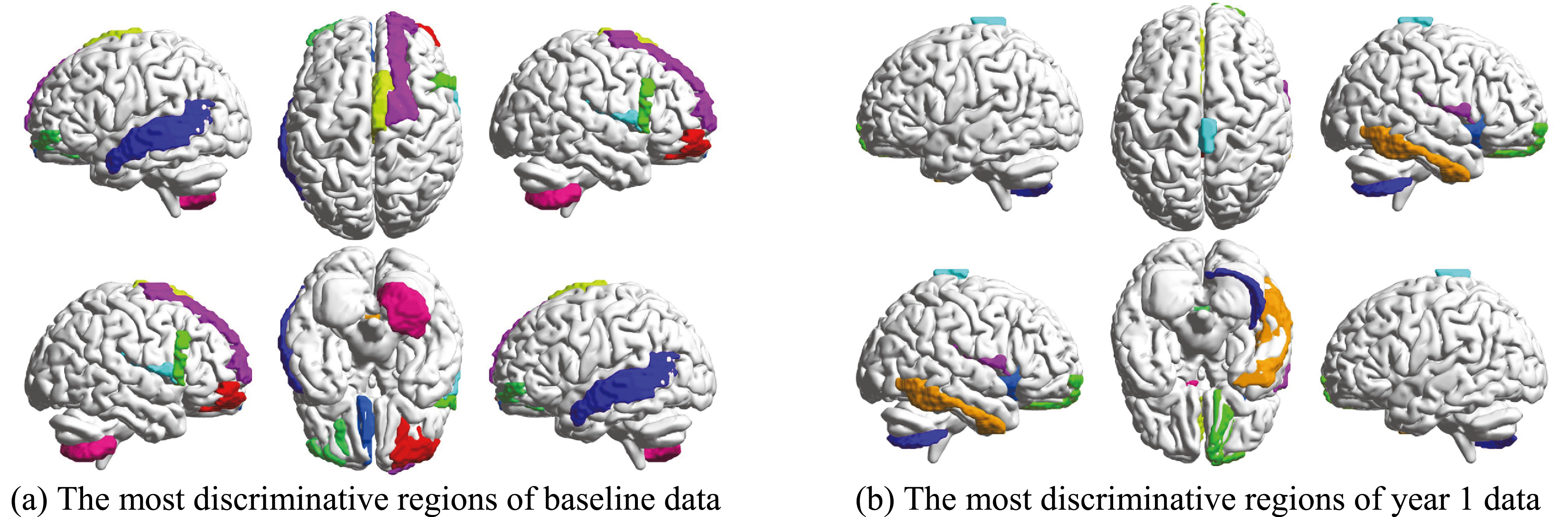 The selected most discriminative brain regions.