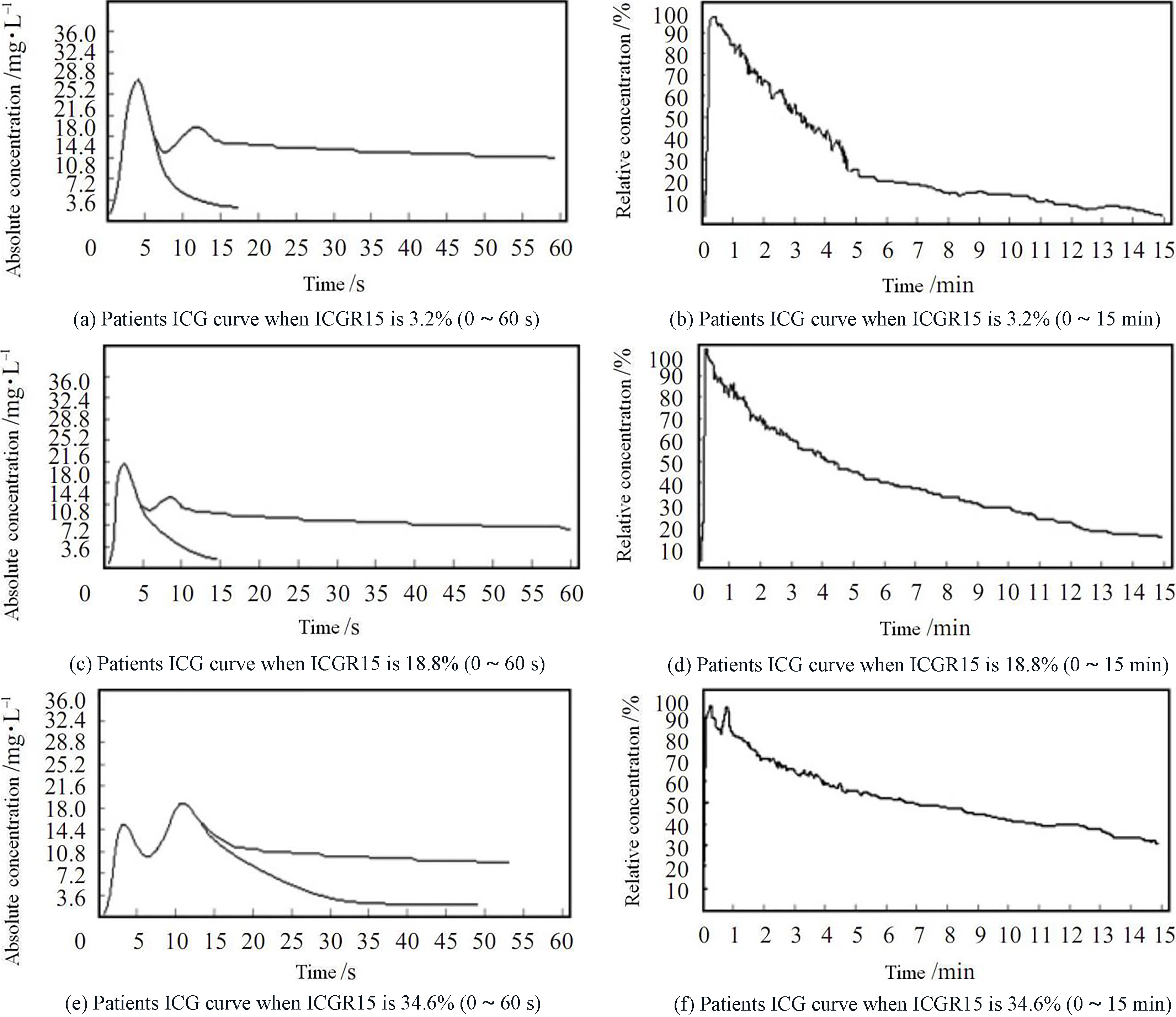 ICG curves of different suspected primary liver cancer patients.
