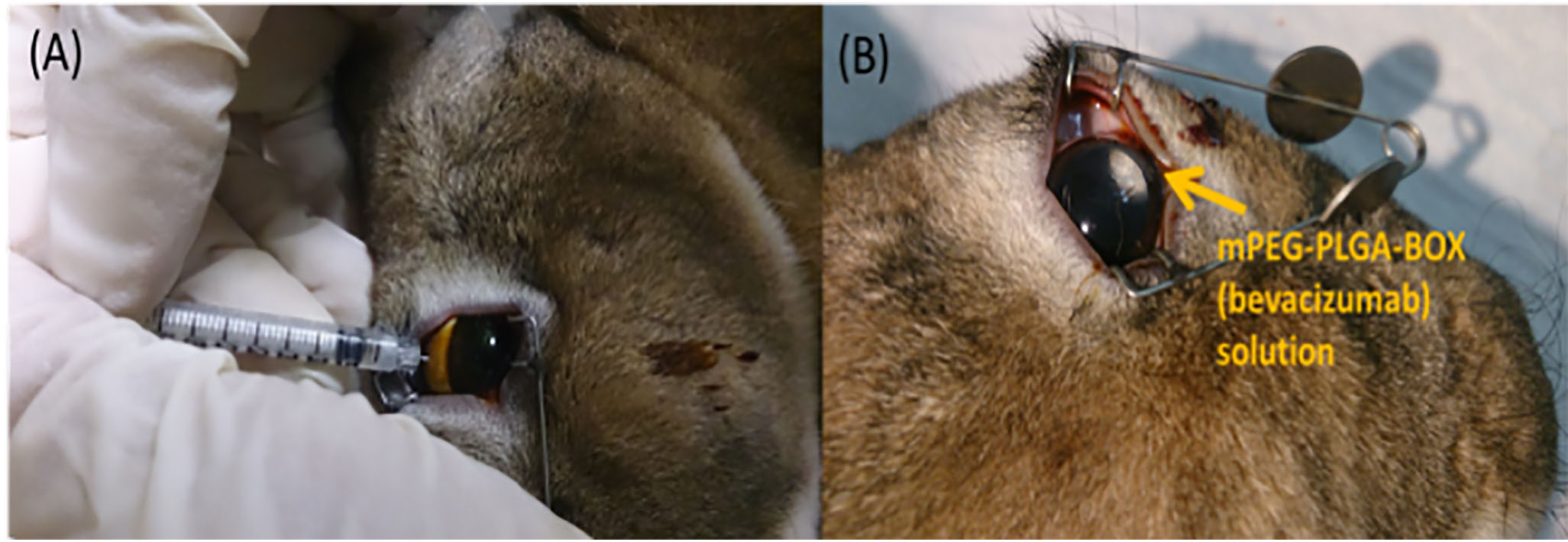 (A) Intravitreal injection of mPEG-PLGA-BOX (bevacizumab) solution at superior position. (B) mPEG-PLGA-BOX (bevacizumab) solution became white and resided at the superior position of the rabbit’s eye.