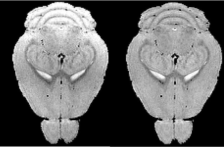 Bias correction result of mouse brain MRM (from left to right: raw MRM image, corrected MRM image).