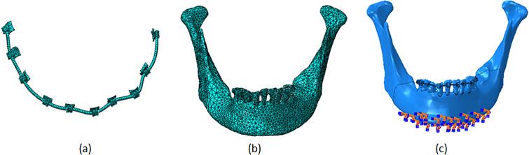 FE model of bracket and archwire (a), FE model of periodontium tissue (b), and the assembly model and boundary condition (c).