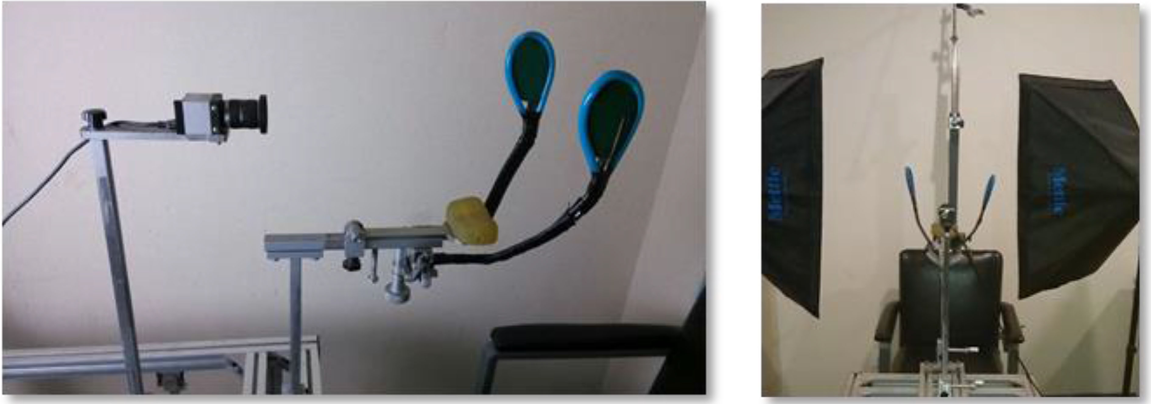 The equipment used for facial paralysis image acquisition.