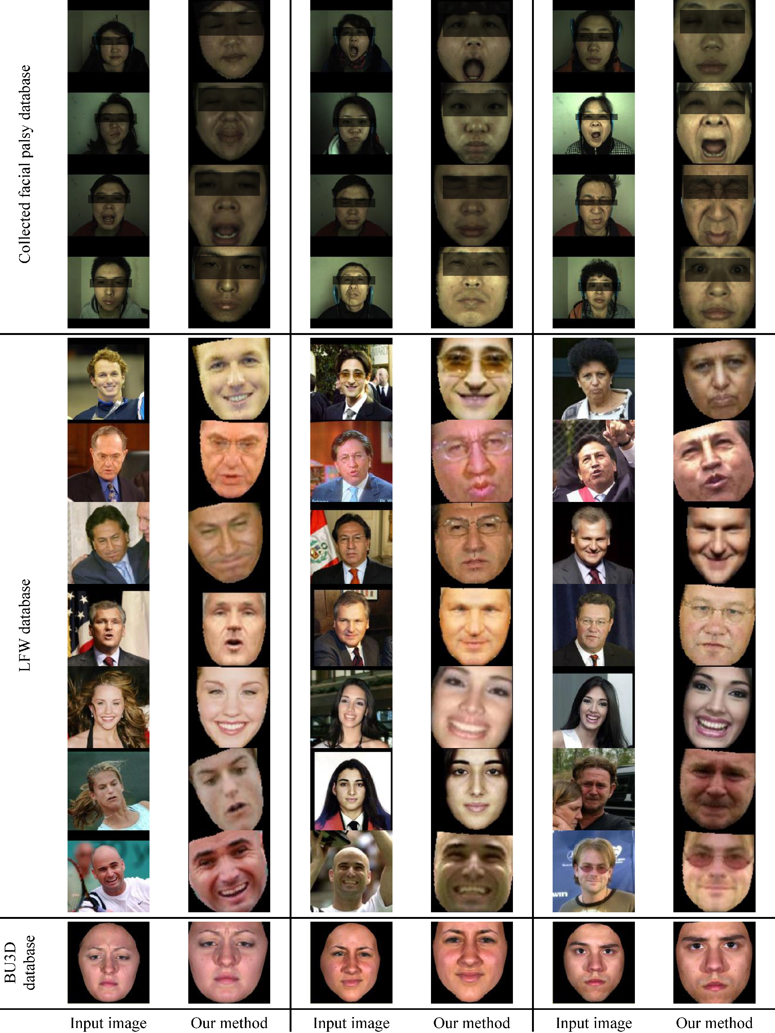 Samples of the experiment results for facial symmetrization on collected facial palsy images, LFW database and BU3D database. It is noticeable that some test examples with large facial performances, head poses or facial occlusions like shades, can be well handled by the proposed model, whereas those conditions can pose more challenges for traditional facial landmark localization based approaches.