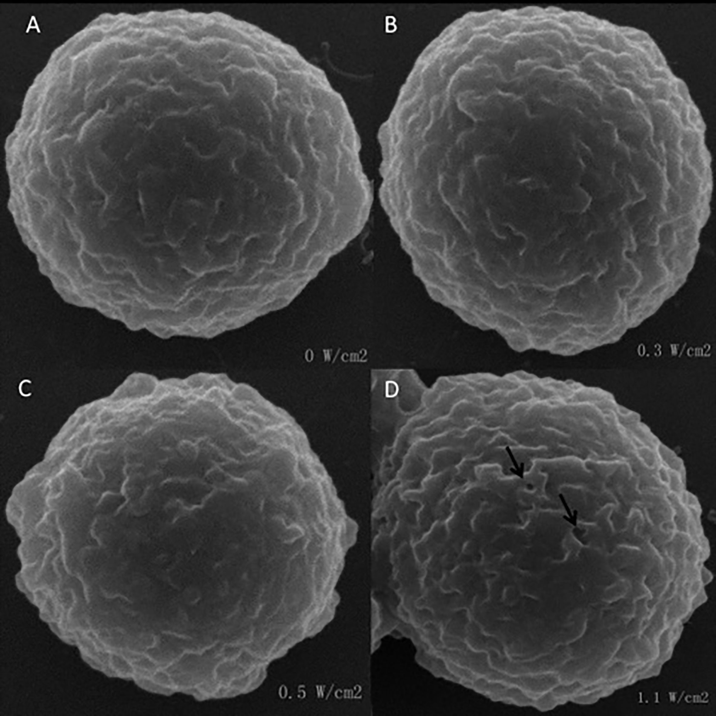 SEM images of SMMC 7721 cells irradiated at an intensity of 0, 0.3, 0.5 and 1.1W/cm2 ultrasound.