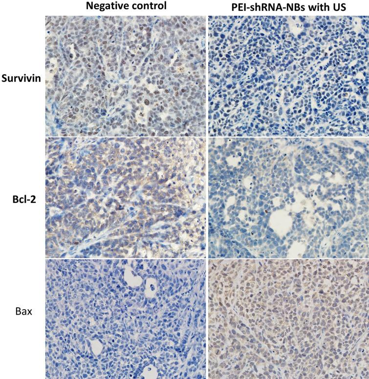 Immunohistochemical assays of hepatoma sections from mice after the treatments. Brown staining indicated the expression of surviving, bcl-2 or bax protein, and the blue staining showed the nuclei, respectively (400×).