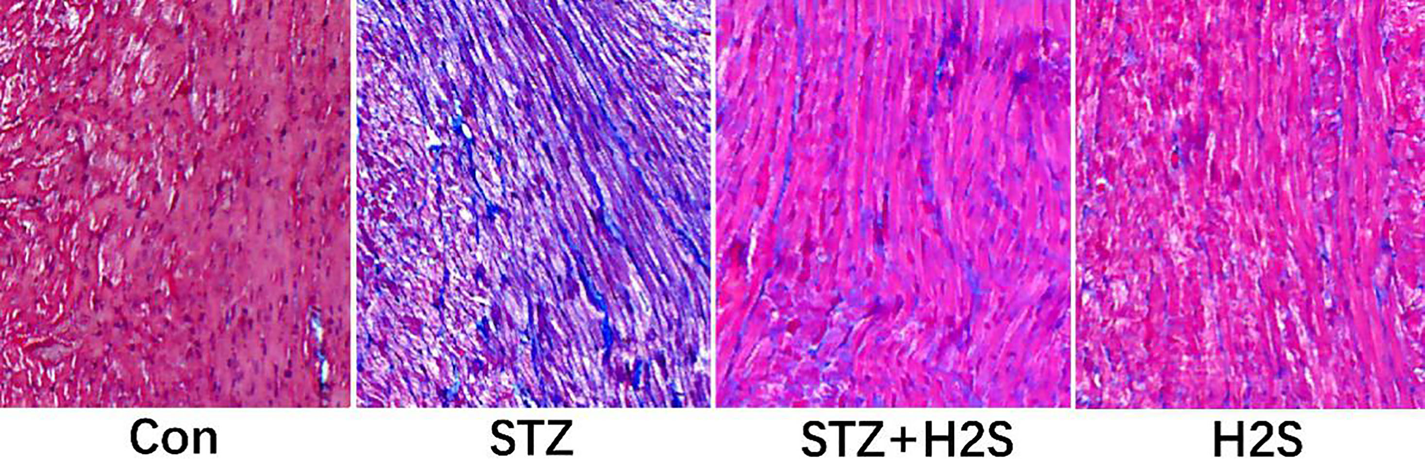 Pathological changes of myocardium assessed by Masson staining (Images were obtained at × 100 magnification).