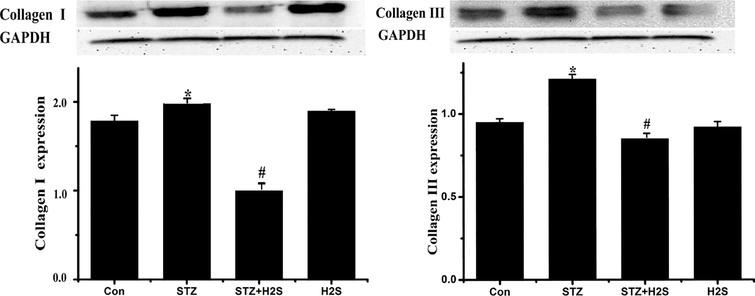 Western blotting results of collagen-I and collagen-III. Data are expressed as mean ± SD (n= 3). P*< 0.05 vs Con group; P#< 0.05 vs STZ group.