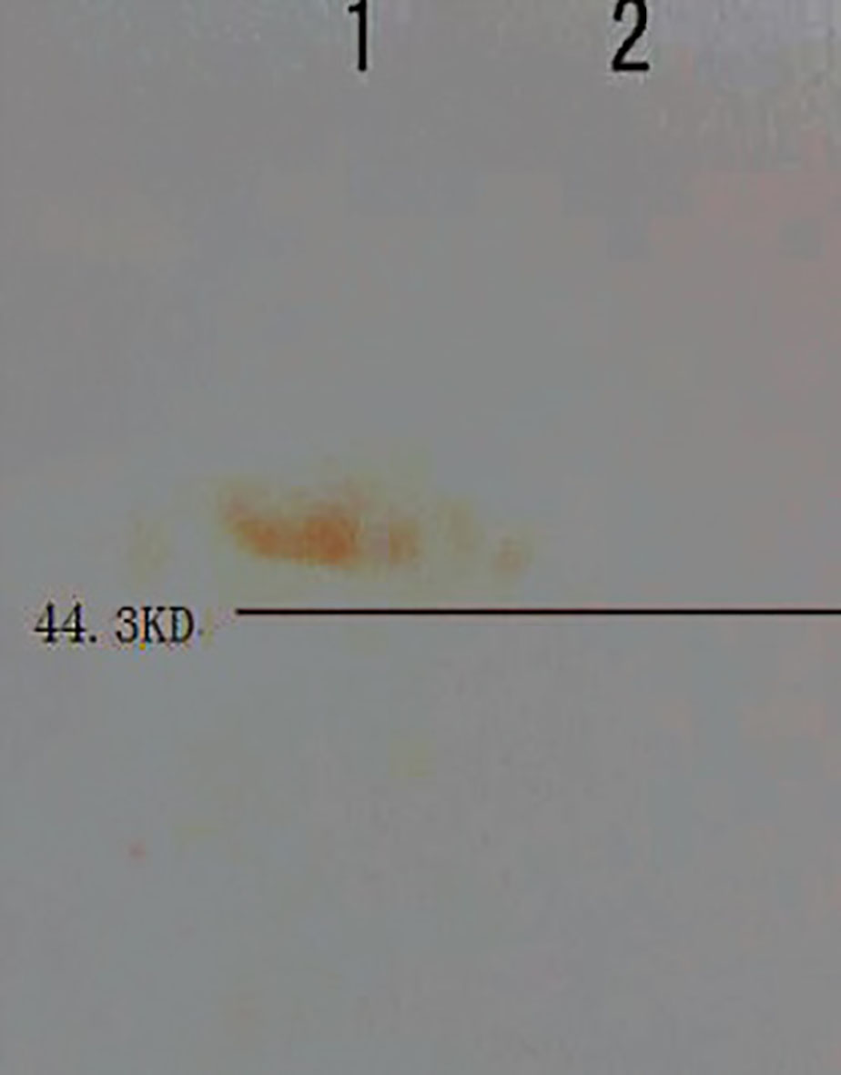 Western Blot of 17β-HSD1 enzyme on rat optic nerve, on the picture lane 1 track is the rat optic nerve sample and lane 2 track is the blank with no sample.