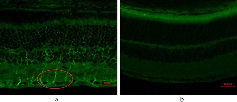 IHC shows 17β-HSD1 enzyme on rat optic nerve. The left shows green signal on layers of retina, inner limiting membrane, nerve fiber layer, ganglion cell layer, inner plexiform layer, inner nuclear layer, outer plexiform layer and outer nuclear layer with red circle in experimental group, the right shows control rats have no signals in retina.