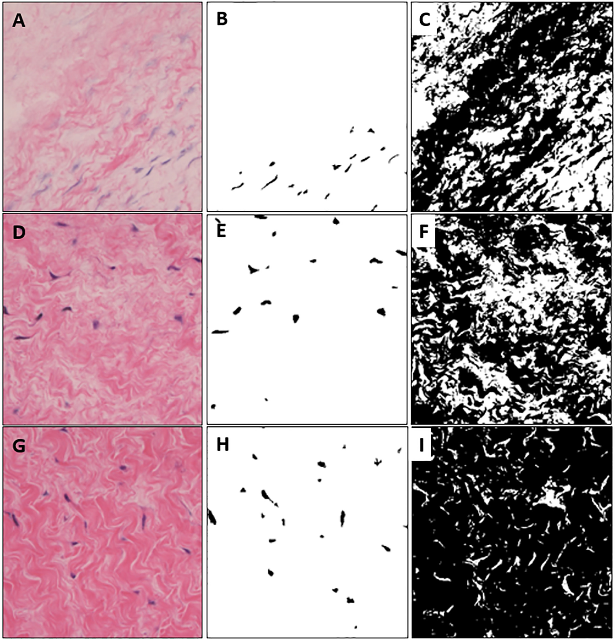 Extracted cell and tissue images from colored microscopic images with different brightness. (A) is high brightness, (D) is medium brightness, (G) is relatively darker brightness than (A) and (D). (B), (E), (H) are extracted cells and (C), (F), (I) are segmented tissue images.
