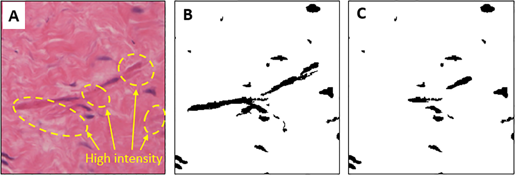Results of Gaussian-weighted image and comparison of cell extraction. (A) is a raw-colored image with high-intensity tissue regions. (B) is the result of recognition of tissue as a cell by high-intensity tissue regions. (C) shows the error correction by the Gaussian-weighted method.