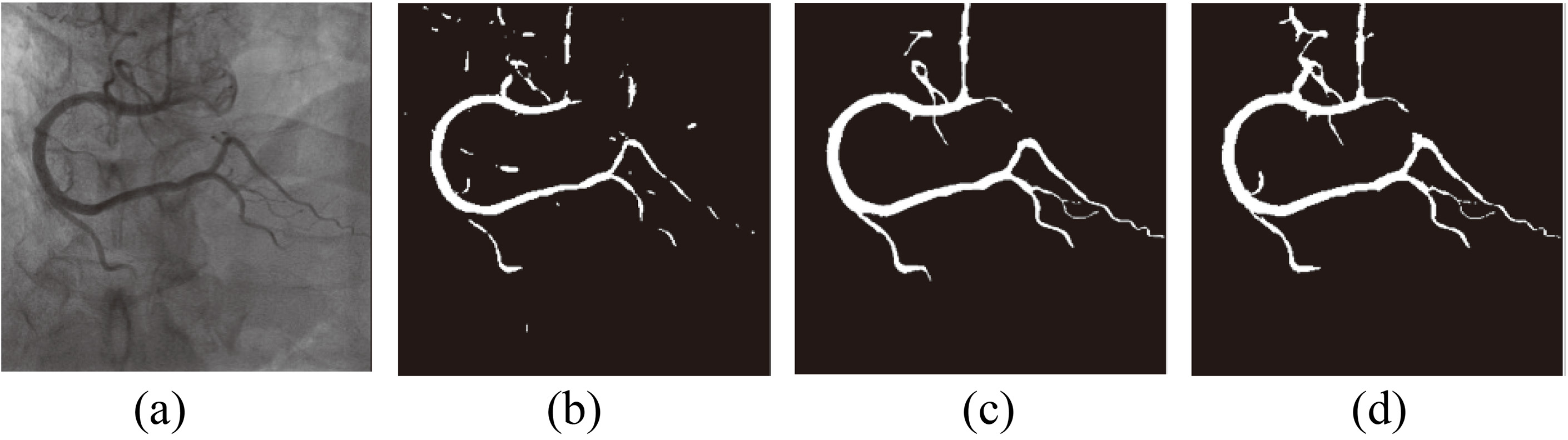 The result of the segmentation. (a) Original image; (b) Ref [10] method; (c) Ref [12] method; (d) Proposed method.