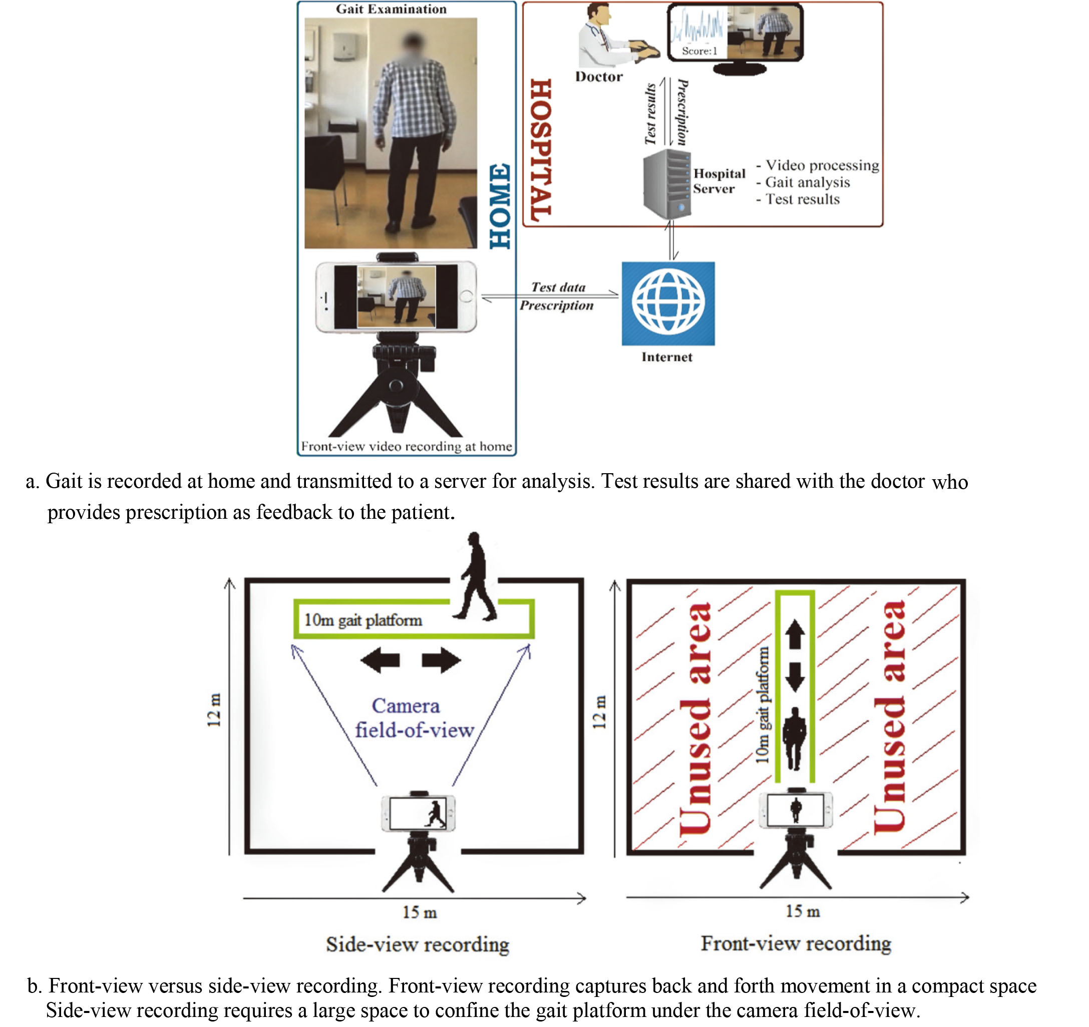 At-home gait assessment based on front-view video analysis.