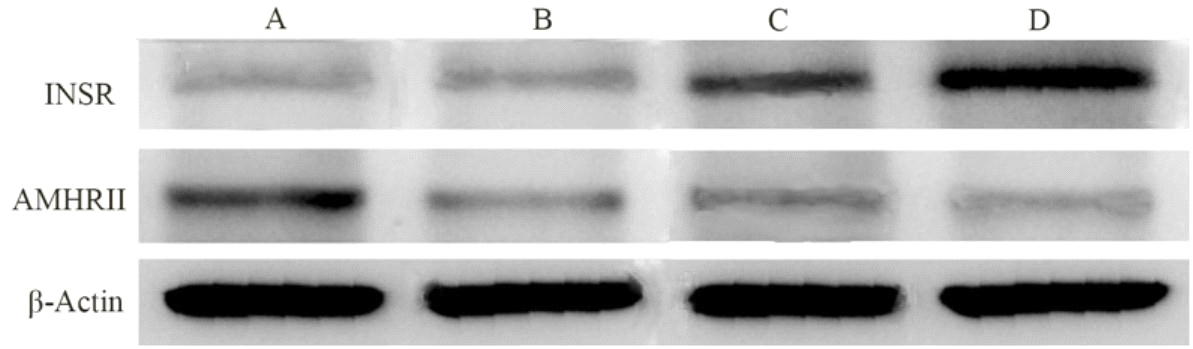 Western blot analysis of AMHRII and INSR proteins. A: ovary of PCOS; B: ovary of control; C: endometrium of PCOS; D: endometrium of control.
