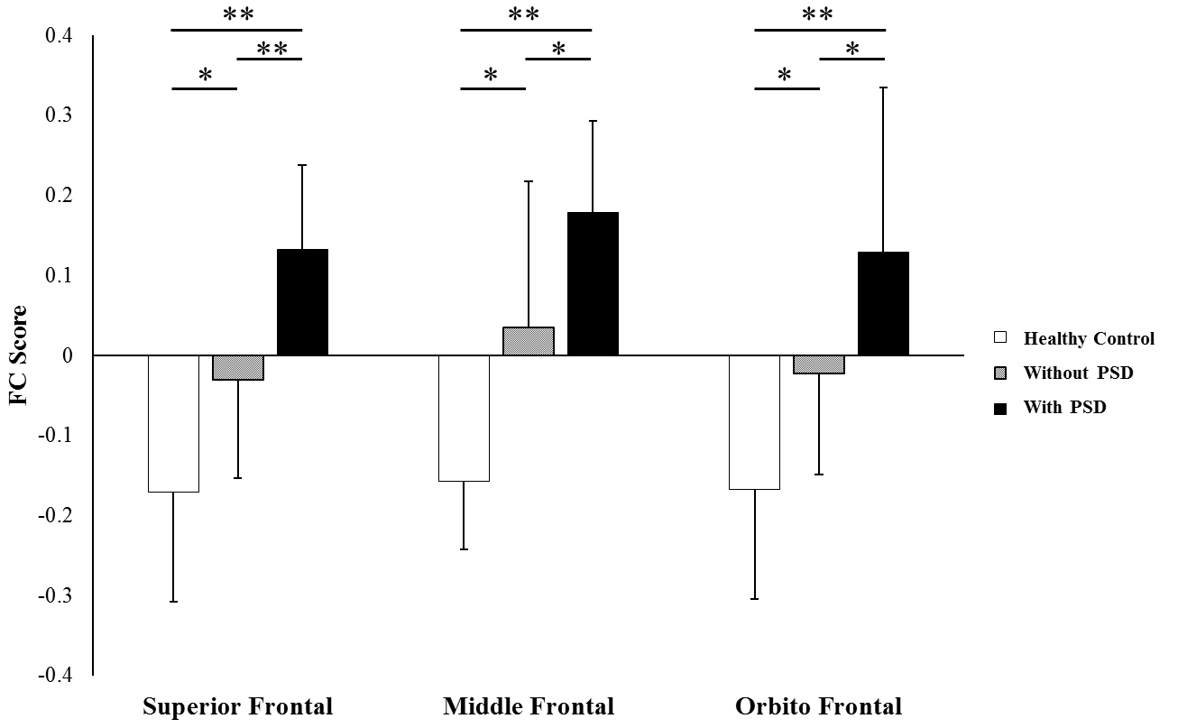 The functional score between the non-affected hemispheric anterior insula and the superior frontal, middle frontal, and orbitofrontal gyrus regions showed significantly statistical differences between patients with PSD group and each of the other groups (patients without PSD group and healthy control group). P*< 0.05, P**< 0.01 indicated.