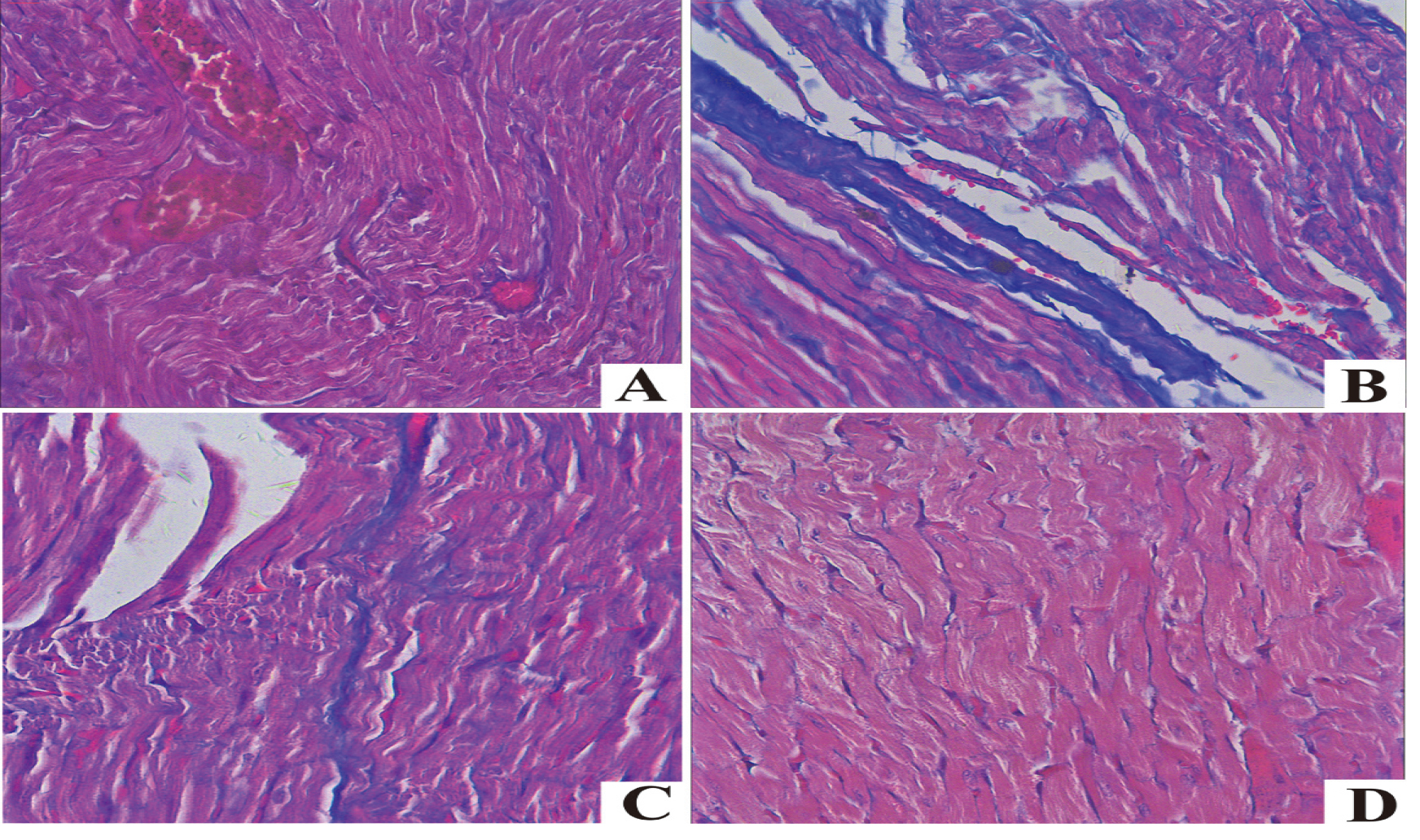Masson staining of myocardial tissues in each group. A. Control; B. DOX; C. DOX+H2S; D. H2S (100 μm).