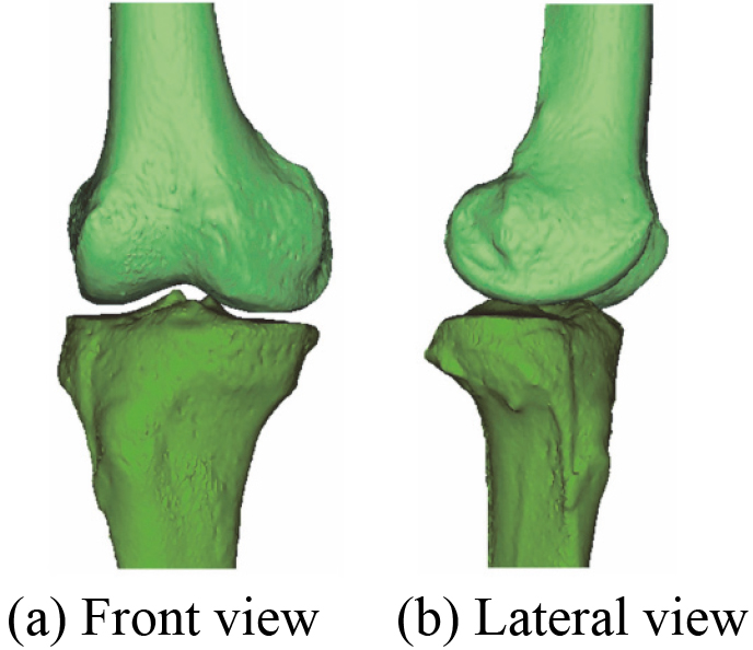The reconstructed 3D bones model based on CT images.