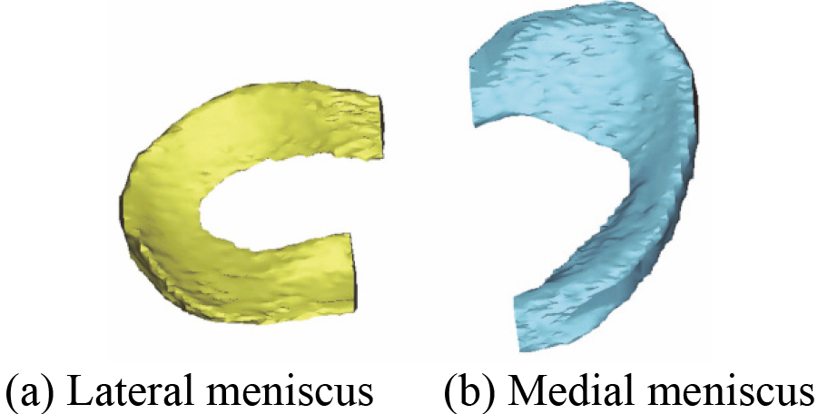 The reconstructed 3D menisci model based on MRI (2D SE T1WI) images.
