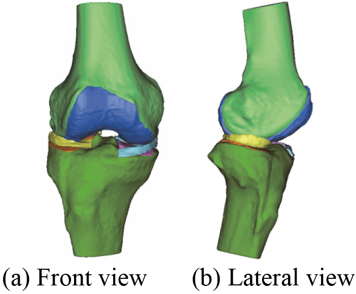 A novel 3D geometric anatomy structure model of human right knee joint.